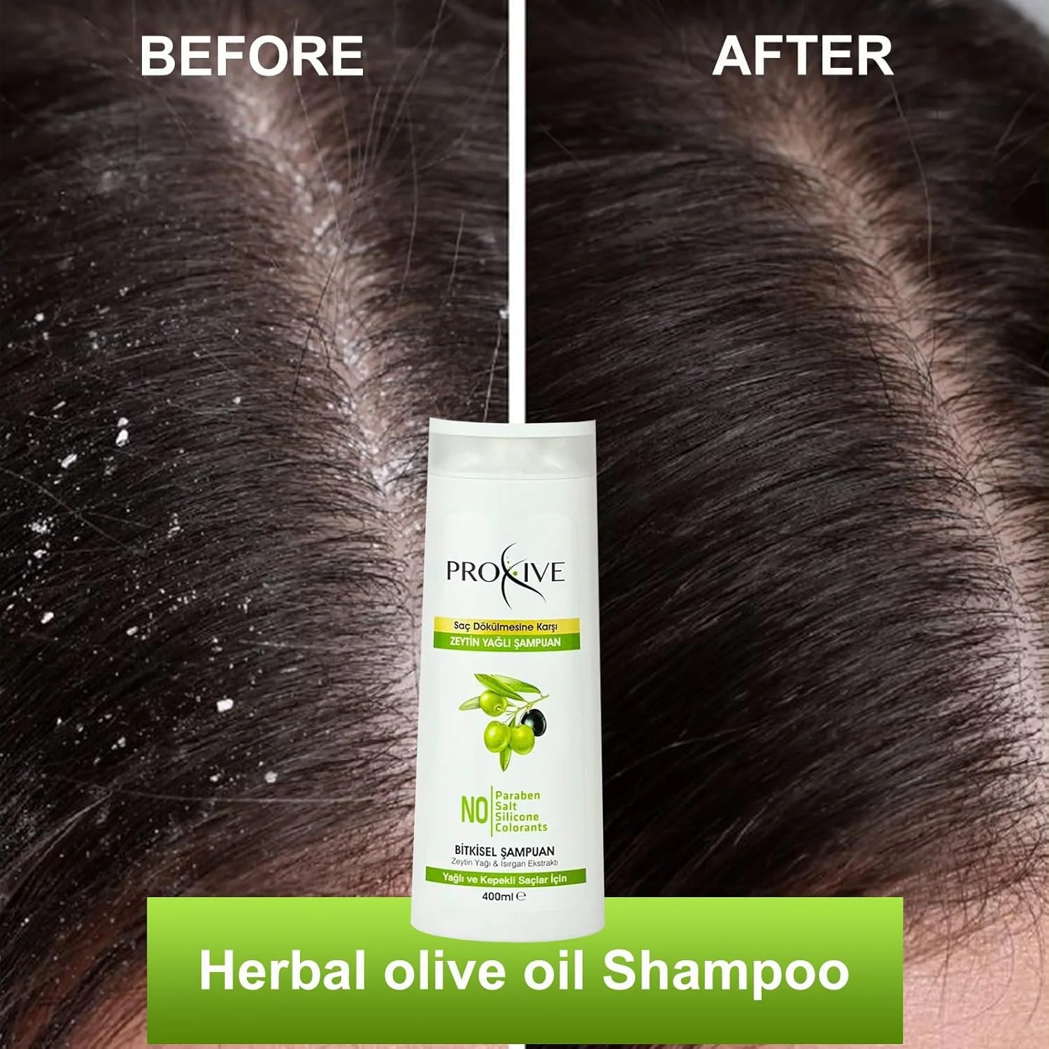شامپو روغن زیتون و گیاهی پروکسیو، مرطوب کننده، مناسب موهای خشک، آبرسان، موهای سالم، مراقبت از پوست سر، فرمول ضد ریزش مو، بدون نمک، بدون پارابن، 400 میلی لیتر، برای موهای چرب و شوره سر/ساخت ترکیه