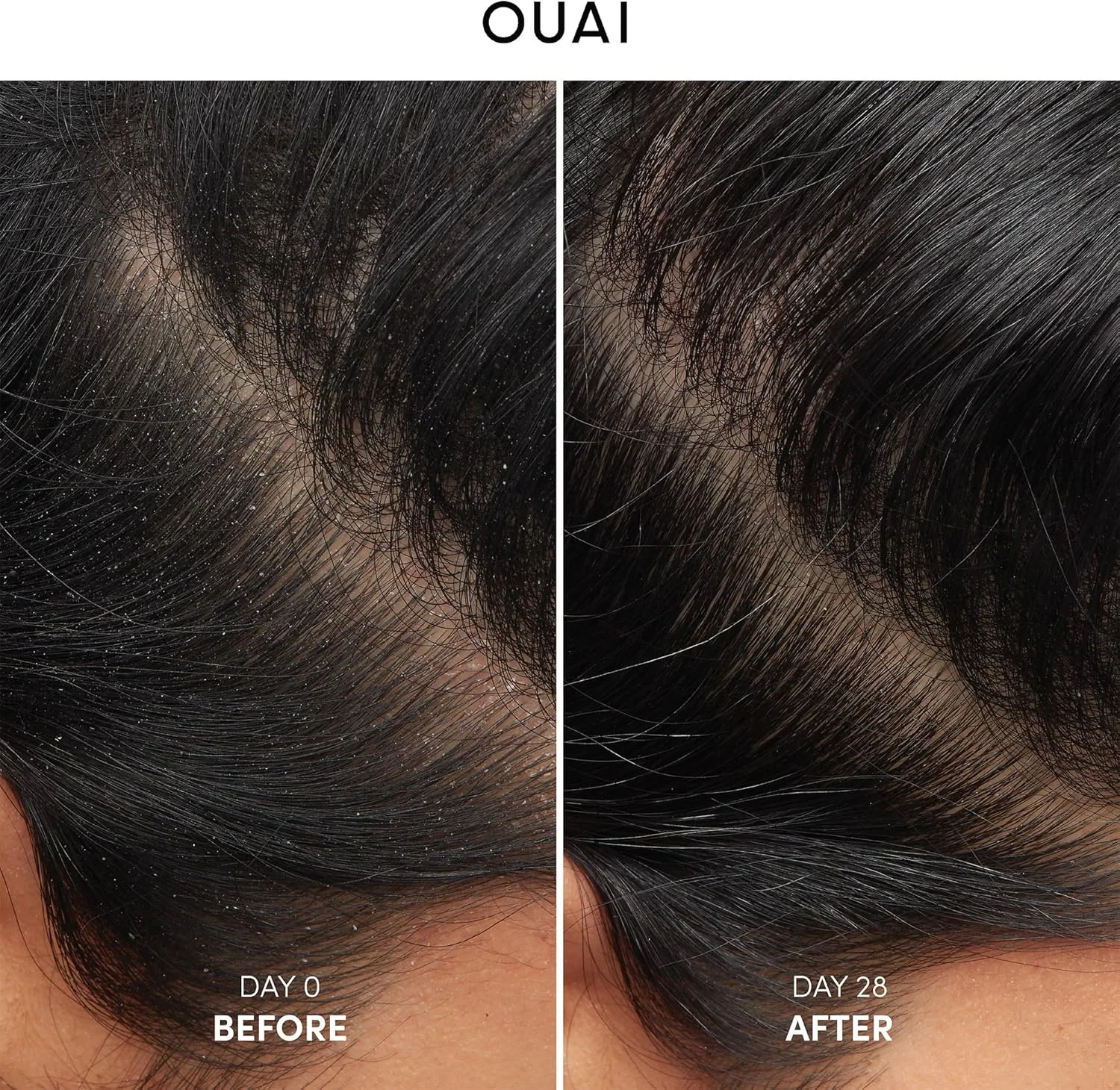 شامپو ضد شوره اوای - شامپو تسکین دهنده حاوی اسید سالیسیلیک برای پوست سر پوسته پوسته، خشک و خارش دار - کاهش خارش، قرمزی و تحریک - مراقبت از پوست سر بدون سولفات (295 میلی لیتر)