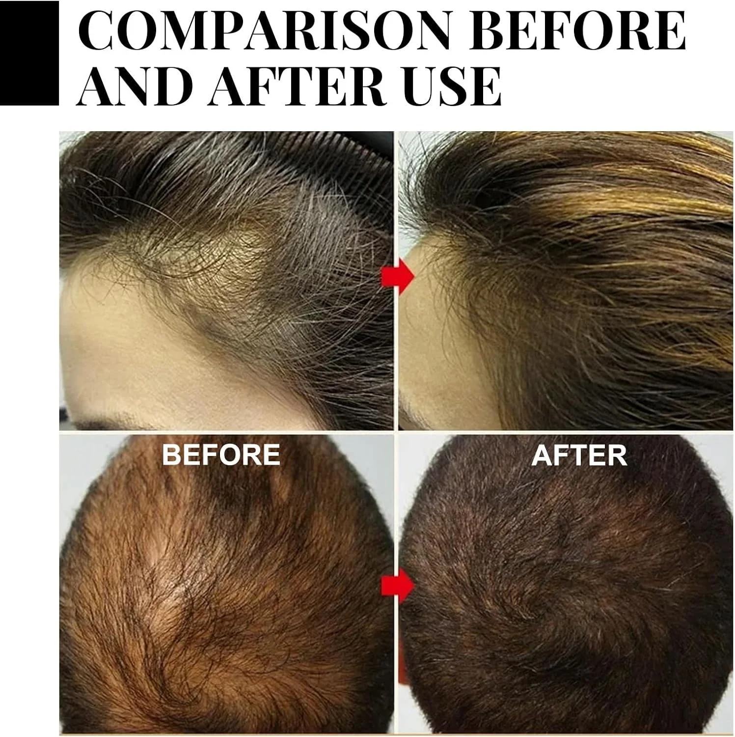 شامپو بار روغن باتانا ارگانیک NALACAL، شامپو بار برای تقویت مو، شامپو جامد روغن باتانا خالص، شامپو بار طبیعی تمیز کننده، کنترل چربی، تغذیه کننده، صاف کننده، براق کننده و ضخیم کننده مو شامپو بار روغن باتانا ارگانیک NALACAL، شامپو بار برای تقویت مو، شامپو جامد روغن باتانا خالص، شامپو بار طبیعی تمیز کننده، کنترل چربی، تغذیه کننده، صاف کننده، براق کننده و ضخیم کننده مو