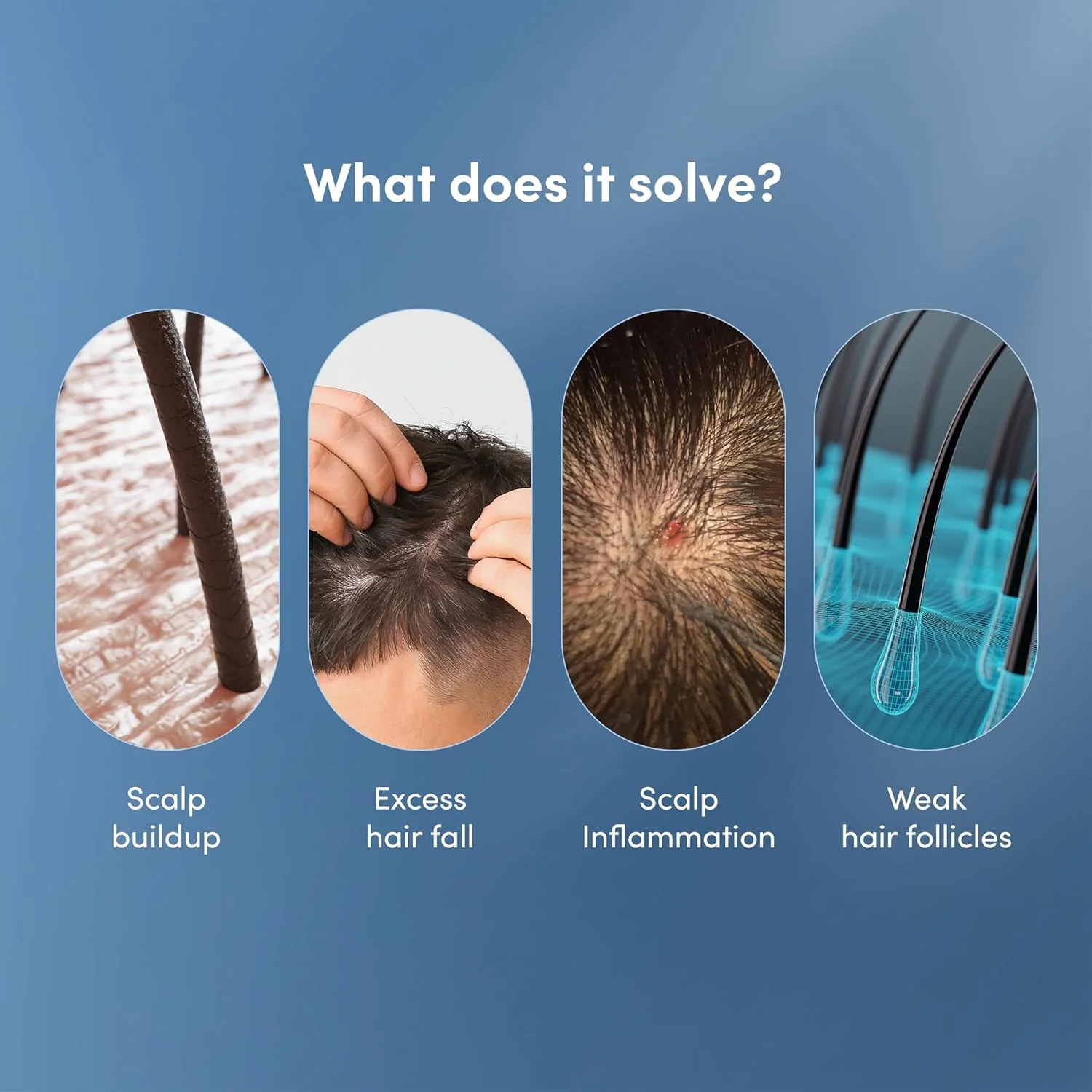 شامپو ضد ریزش مو مردانه من matters | کاهش ریزش مو | با قدرت کافئین، سائو پالمتو، روغن آرگان و بیوتین (300 میلی لیتر)