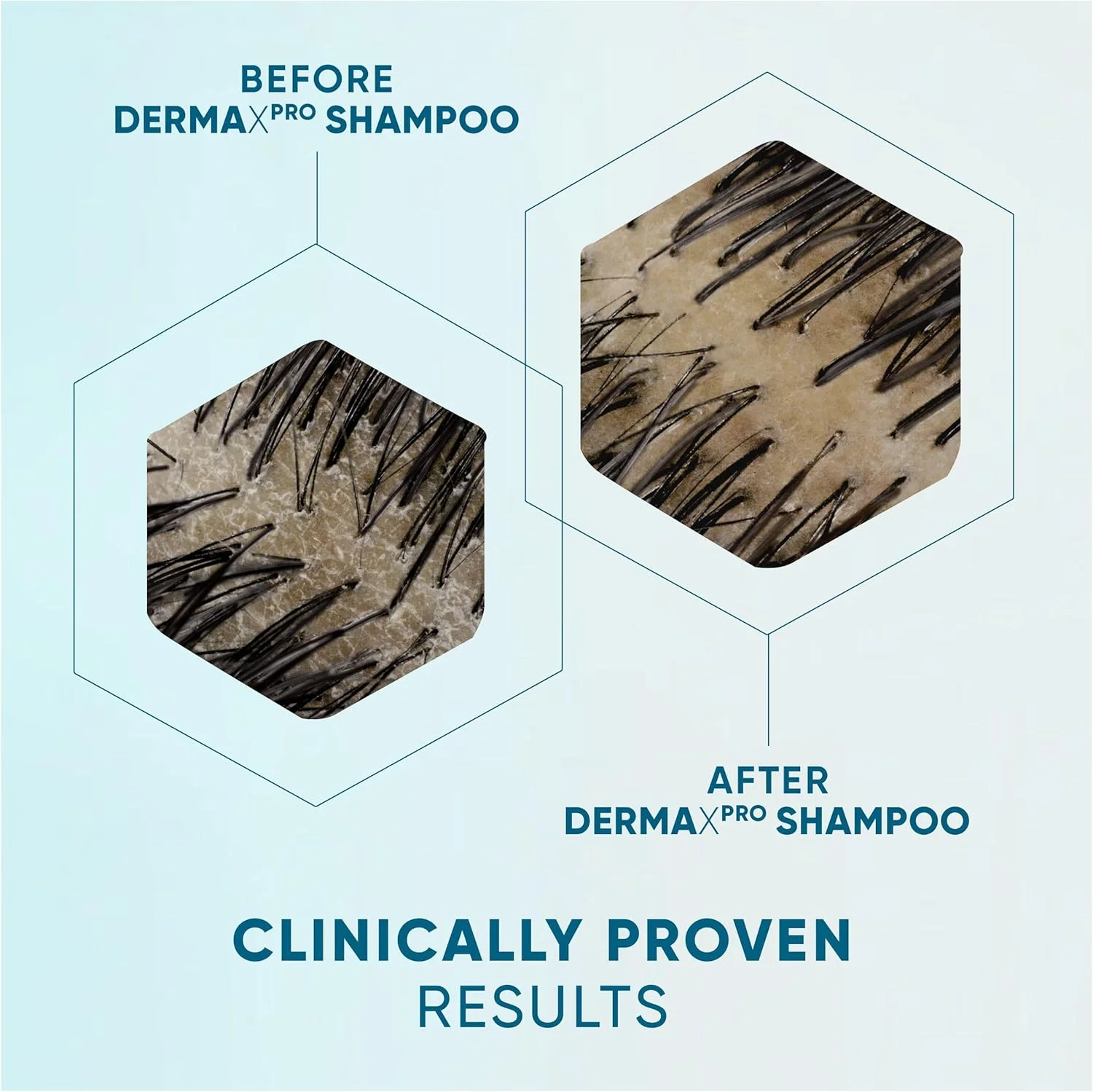 شامپو ضد شوره سر و احیا کننده مو هد اند شولدرز DermaXPro با حجم 300 میلی لیتر، حاوی کافئین و کمپلکس سرامید. مرطوب کننده پوست سر خشک و موهای نازک و کمک به تقویت سد پوستی شامپو ضد شوره سر و احیا کننده مو هد اند شولدرز DermaXPro با حجم 300 میلی لیتر، حاوی کافئین و کمپلکس سرامید. مرطوب کننده پوست سر خشک و موهای نازک و کمک به تقویت سد پوستی