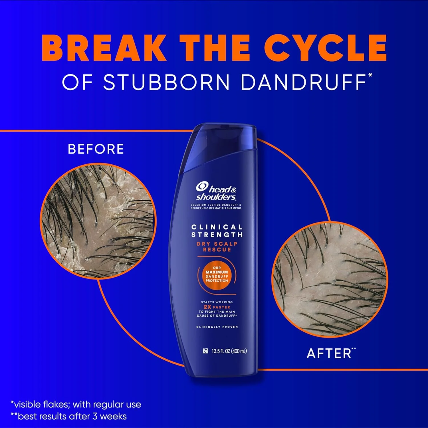 شامپو ضد شوره و تسکین دهنده پوست سر خشک هد اند شولدرز کلینیکال، 400 میلی لیتر، بسته دوتایی شامپو ضد شوره و تسکین دهنده پوست سر خشک هد اند شولدرز کلینیکال، 400 میلی لیتر، بسته دوتایی