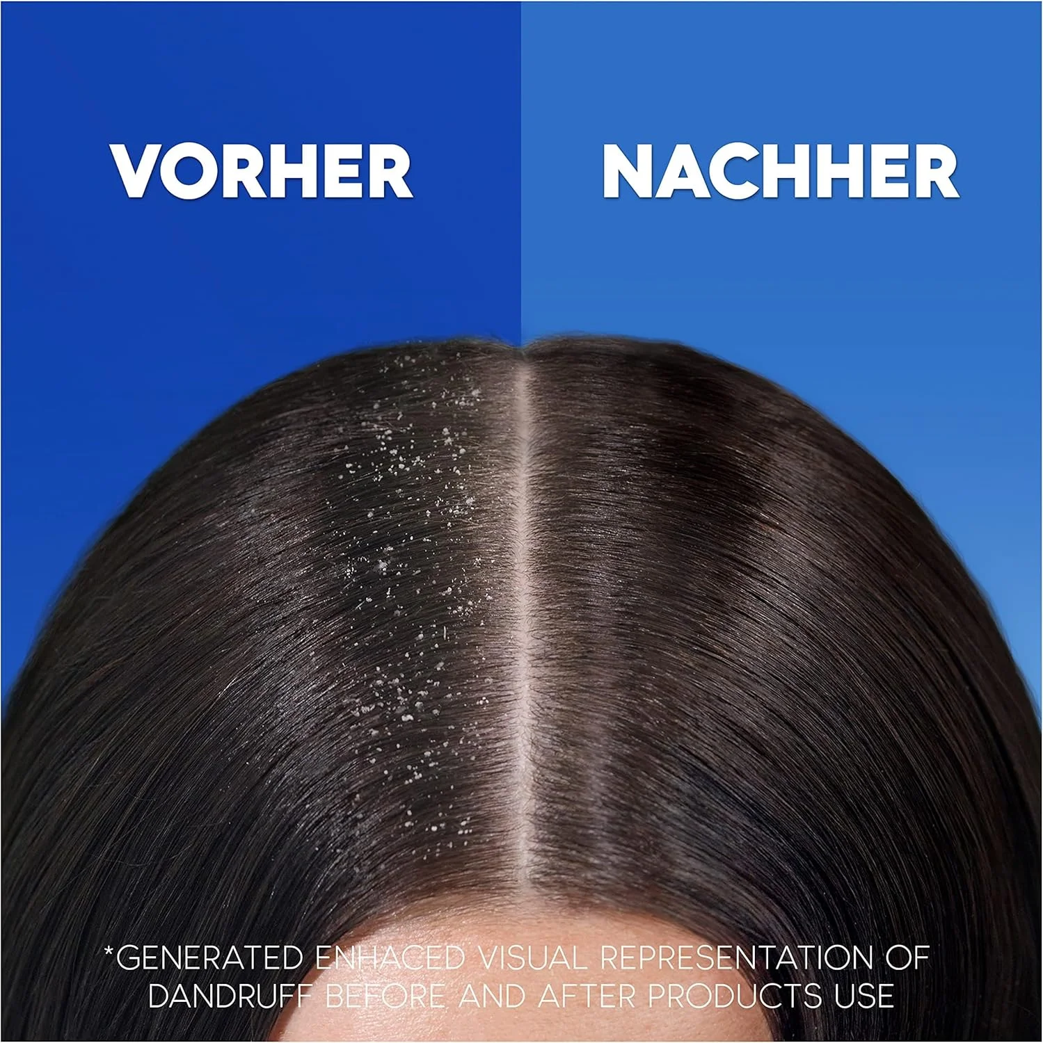 شامپو ضد شوره سر و خارش دار هد اند شولدرز، محافظت از مو و پوست سر در برابر شوره تا 100%، از نظر بالینی تایید شده، تست شده توسط متخصصین پوست، 300 میلی لیتر شامپو ضد شوره سر و خارش دار هد اند شولدرز، محافظت از مو و پوست سر در برابر شوره تا 100%، از نظر بالینی تایید شده، تست شده توسط متخصصین پوست، 300 میلی لیتر