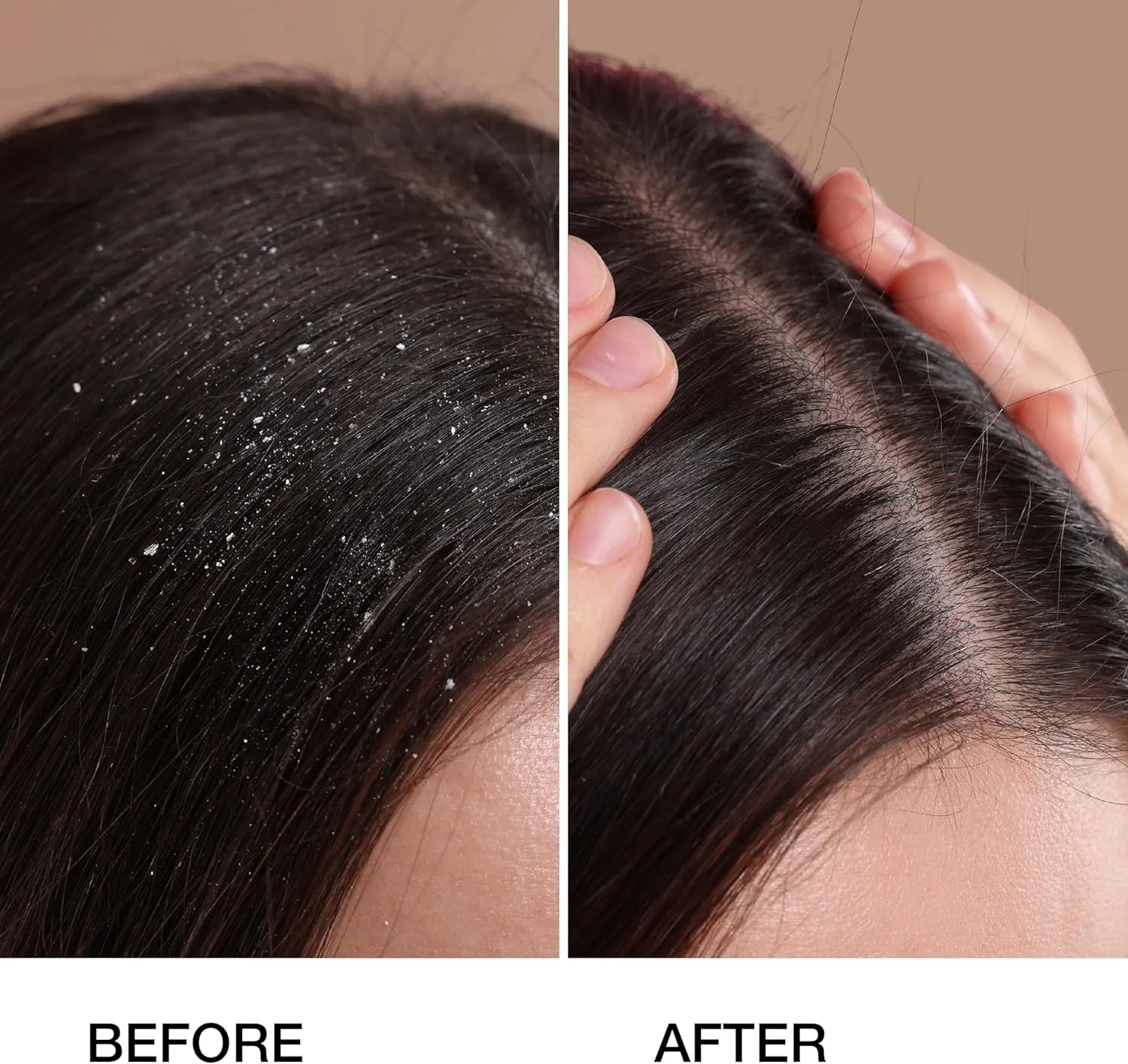 شامپو ضد شوره مو گلوبال کراتین جی کی هیر - 250 میلی لیتر، پاک کننده عمیق مو و از بین برنده آلودگی ها، بدون سولفات، مناسب موهای خشک و آسیب دیده، مناسب برای خانم ها و آقایان شامپو ضد شوره مو گلوبال کراتین جی کی هیر - 250 میلی لیتر، پاک کننده عمیق مو و از بین برنده آلودگی ها، بدون سولفات، مناسب موهای خشک و آسیب دیده، مناسب برای خانم ها و آقایان