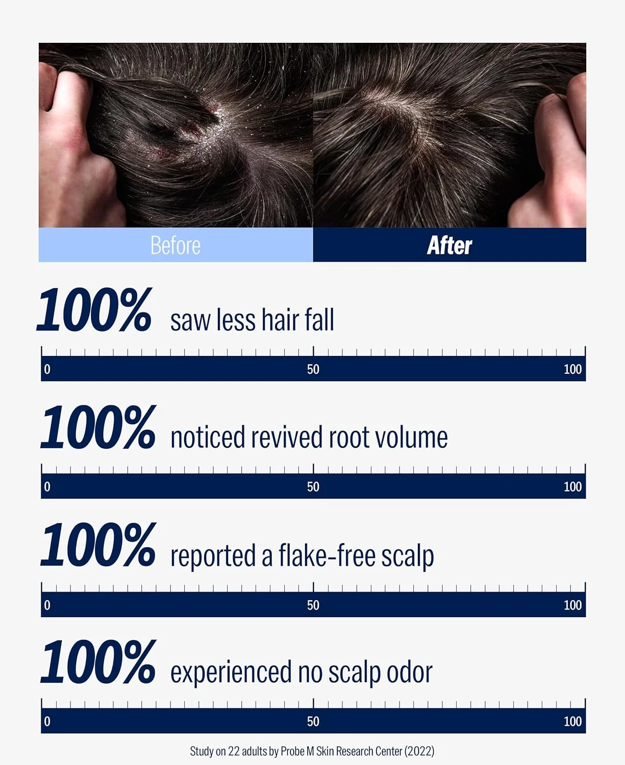 شامپو سر دشو با عصاره طب شرقی