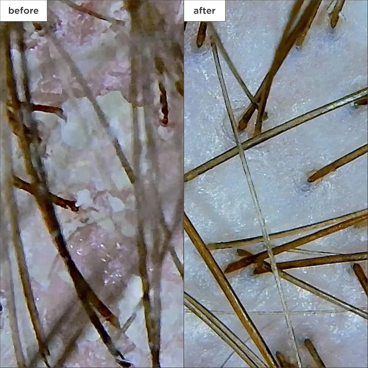 شامپو ضد شوره سر بریوجیو حاوی 3% اسید سالیسیلیک مناسب پوست سر خشک، 248 میلی لیتر