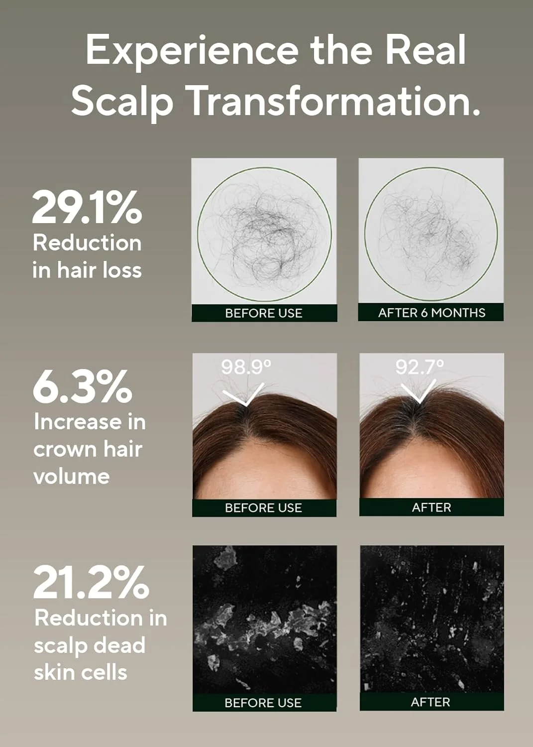 شامپو اسکراب نمک رزماری آروماتیکا - شامپو سم زدای پوست سر کره ای ضد ریزش مو با روغن رزماری | لایه بردار پوست سر با اسکراب نمک برای پوست سر چرب | بدون سولفات، بدون سیلیکون 300 گرم شامپو اسکراب نمک رزماری آروماتیکا - شامپو سم زدای پوست سر کره ای ضد ریزش مو با روغن رزماری | لایه بردار پوست سر با اسکراب نمک برای پوست سر چرب | بدون سولفات، بدون سیلیکون 300 گرم