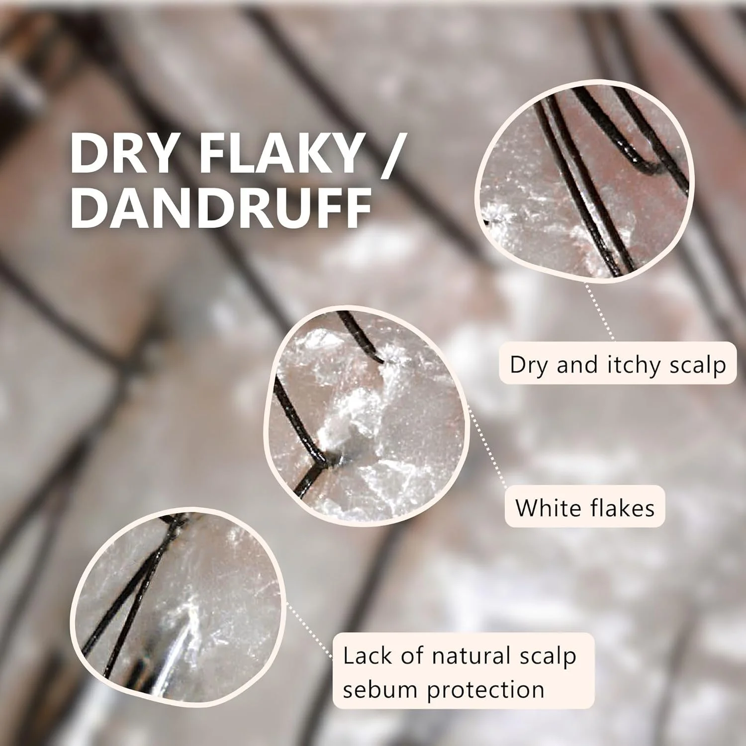 شامپو تسکین دهنده پوست سر خشک AROMASE برای پوست سر خشک، خارش دار و پوسته پوسته - طراحی شده برای تسکین خارش پوست سر و ایجاد آرامش ماندگار به آرامی شامپو تسکین دهنده پوست سر خشک AROMASE برای پوست سر خشک، خارش دار و پوسته پوسته - طراحی شده برای تسکین خارش پوست سر و ایجاد آرامش ماندگار به آرامی