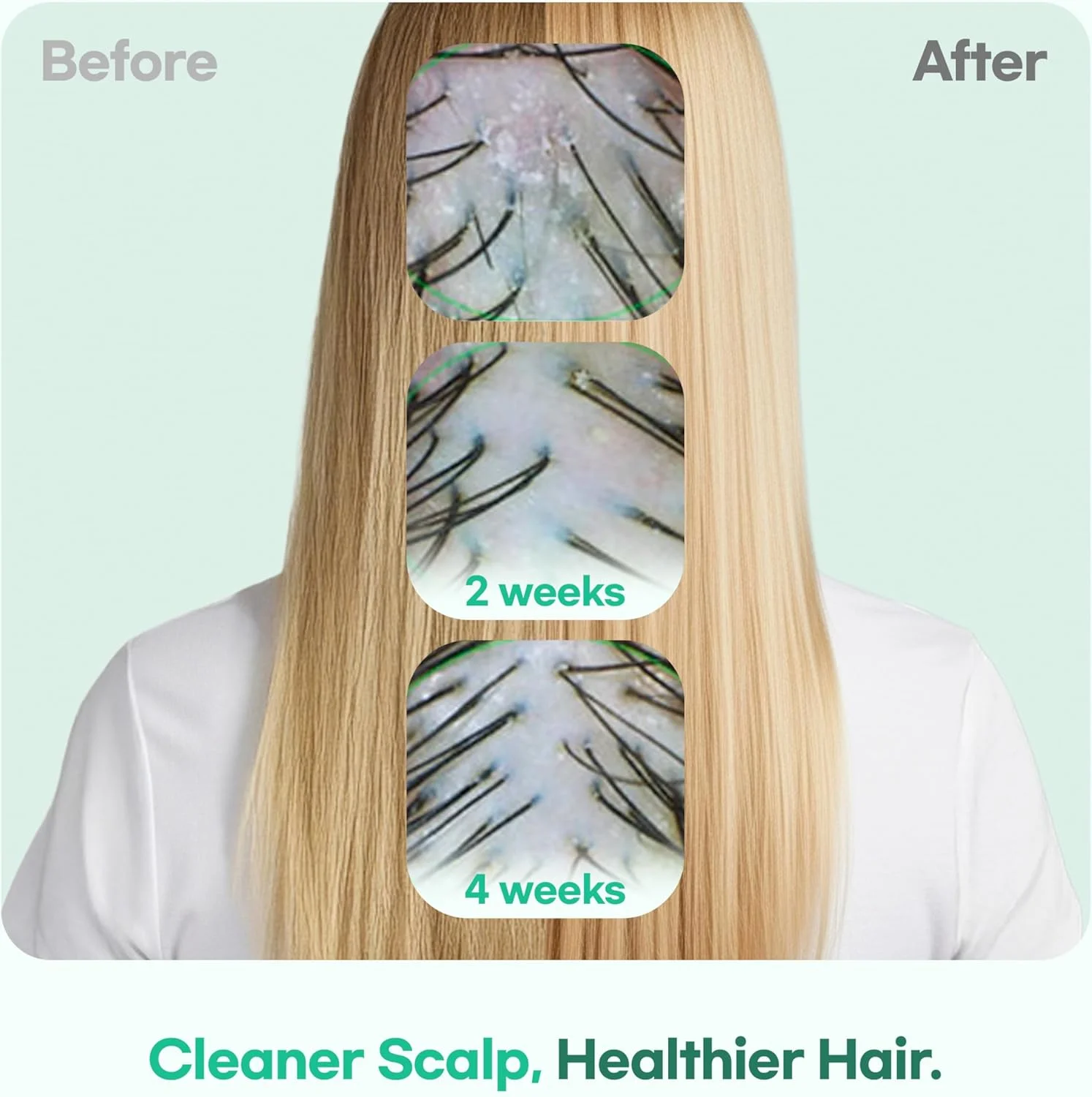 شامپو TS GD برای شوره سر و خارش پوست سر (400 میلی لیتر) شامپو مناسب جوانان و نوجوانان | درمان برای نوجوانان | بدون آلرژن | بدون سیلیکون، SLS، SLES