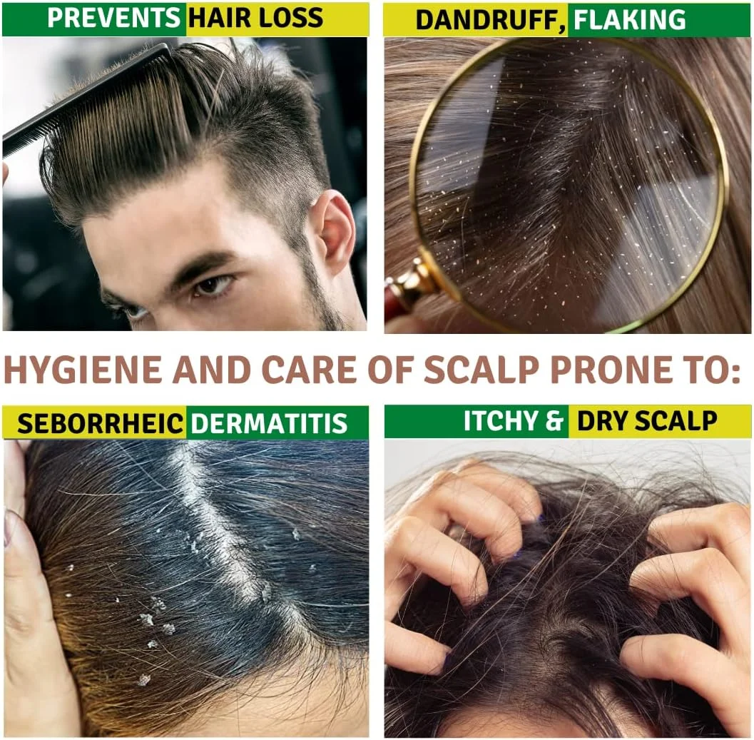 شامپو ضد شوره سولفور TIS - کاهش شوره سر، درماتیت سبورئیک، موهای چرب، برای پوست سر دارای سبوره، ریزش مو، تحریک رشد مو - حاوی باباآدم بزرگ - 100 میلی لیتر