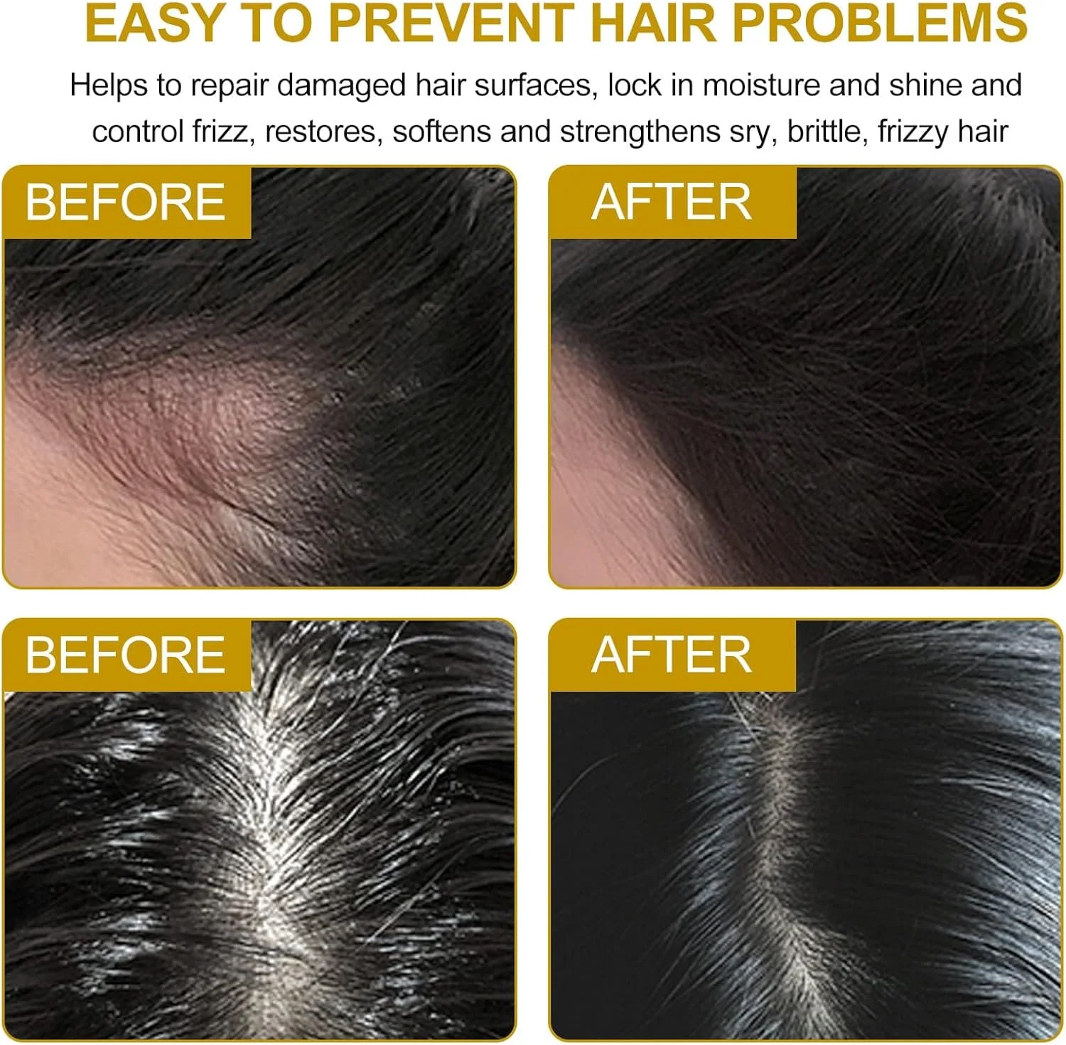 شامپو بار زنجبیلی برای رشد مجدد مو، 2 عدد شامپو بار زنجبیلی طبیعی، ضد شوره، درمان ریزش مو، تقویت رشد مو برای انواع مو