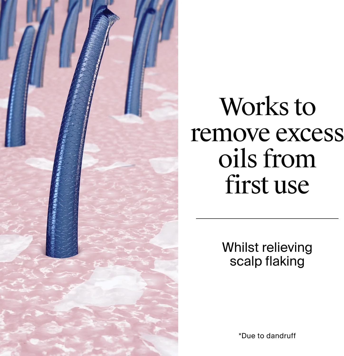 شامپو ضد شوره نوتروژینا T/Gel برای پوست سر و موهای چرب (1x 250ml)، شامپو ضد شوره روزانه با اسید سالیسیلیک، شامپو پاک کننده برای از بین بردن چربی اضافی و مبارزه با شوره سر از اولین شستشو شامپو ضد شوره نوتروژینا T/Gel برای پوست سر و موهای چرب (1x 250ml)، شامپو ضد شوره روزانه با اسید سالیسیلیک، شامپو پاک کننده برای از بین بردن چربی اضافی و مبارزه با شوره سر از اولین شستشو