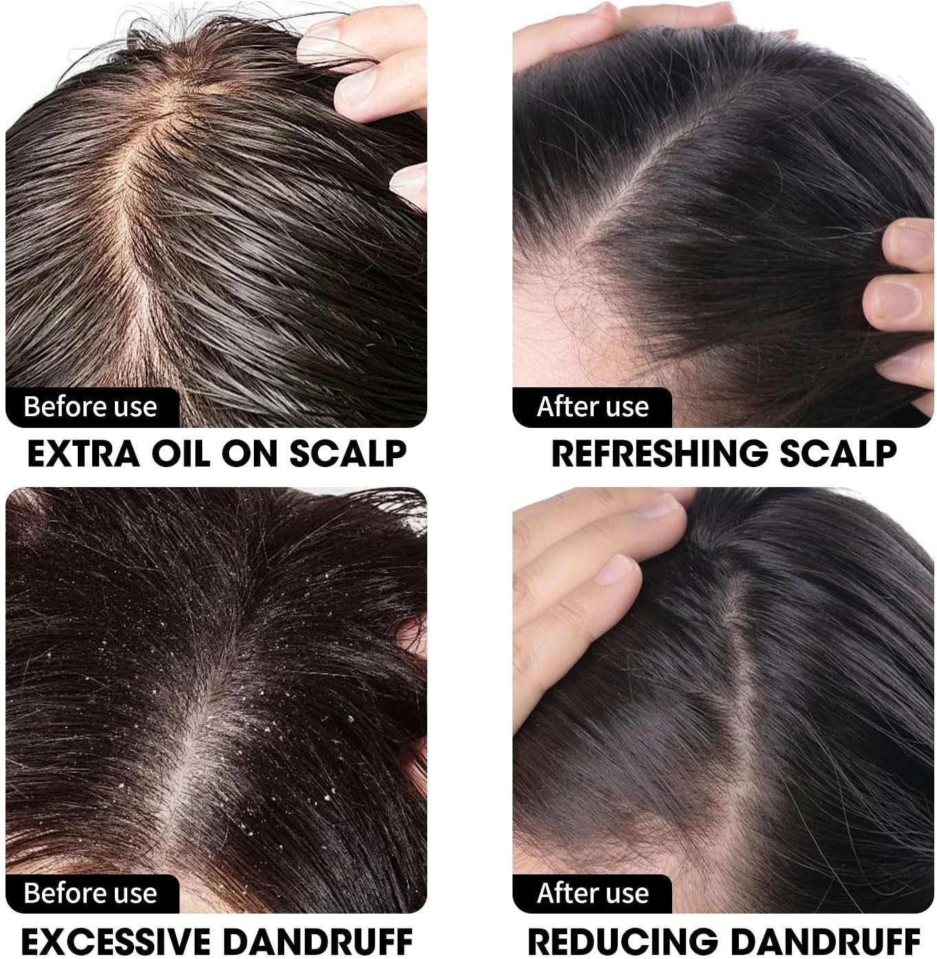 شامپو ضد شوره سر CNMOFAXIN حجم 480 میلی لیتر - تسکین دهنده پوست سر و کنترل کننده پوسته با عصاره های گیاهی - پاک کننده عمیق و مراقبت از سبوم - برای پوست سر چرب موهای خشک و پوست سر خارش دار - محلول مراقبت از موی مناسب برای همه شامپو ضد شوره سر CNMOFAXIN حجم 480 میلی لیتر - تسکین دهنده پوست سر و کنترل کننده پوسته با عصاره های گیاهی - پاک کننده عمیق و مراقبت از سبوم - برای پوست سر چرب موهای خشک و پوست سر خارش دار - محلول مراقبت از موی مناسب برای همه