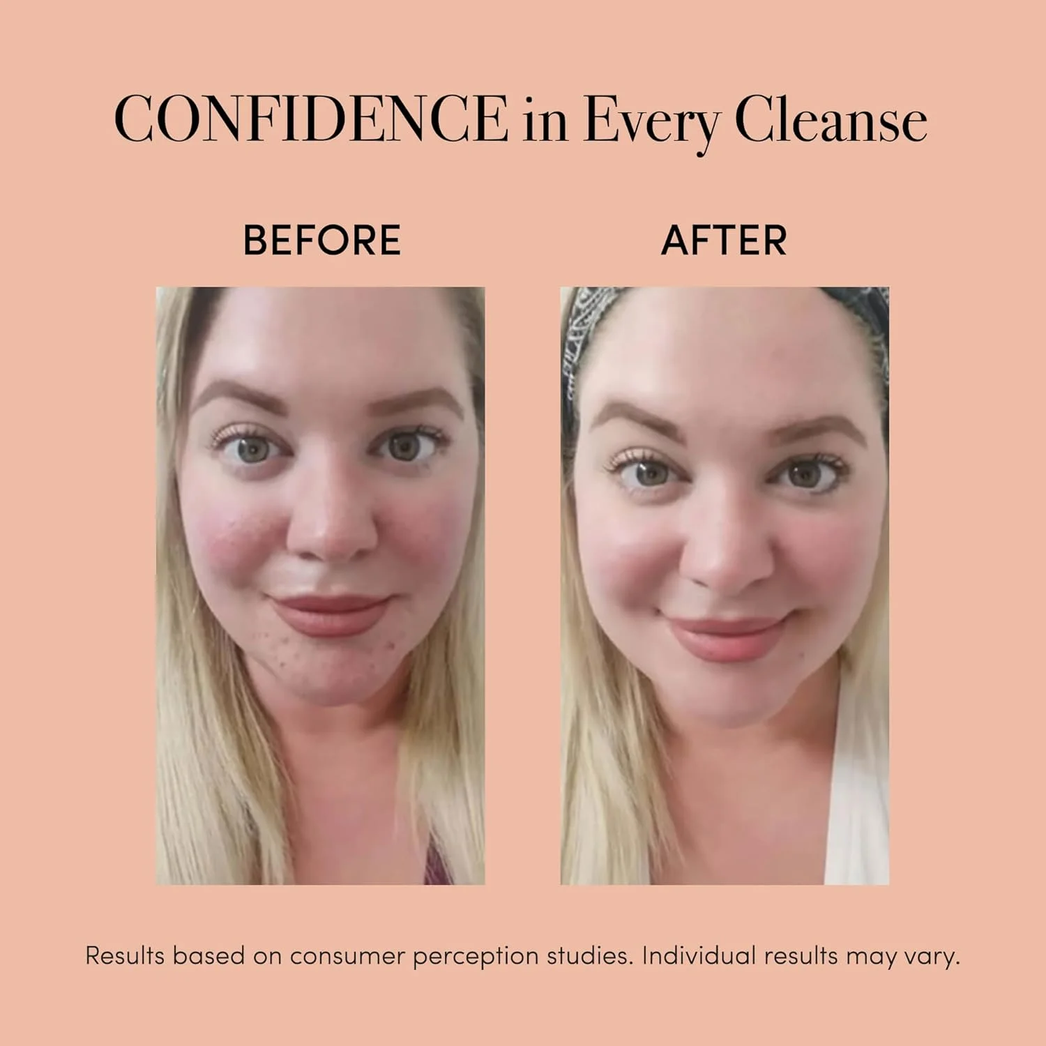 برس پاک کننده صوتی ضد آکنه LED مدل reVive Light Therapy Mini Sonique