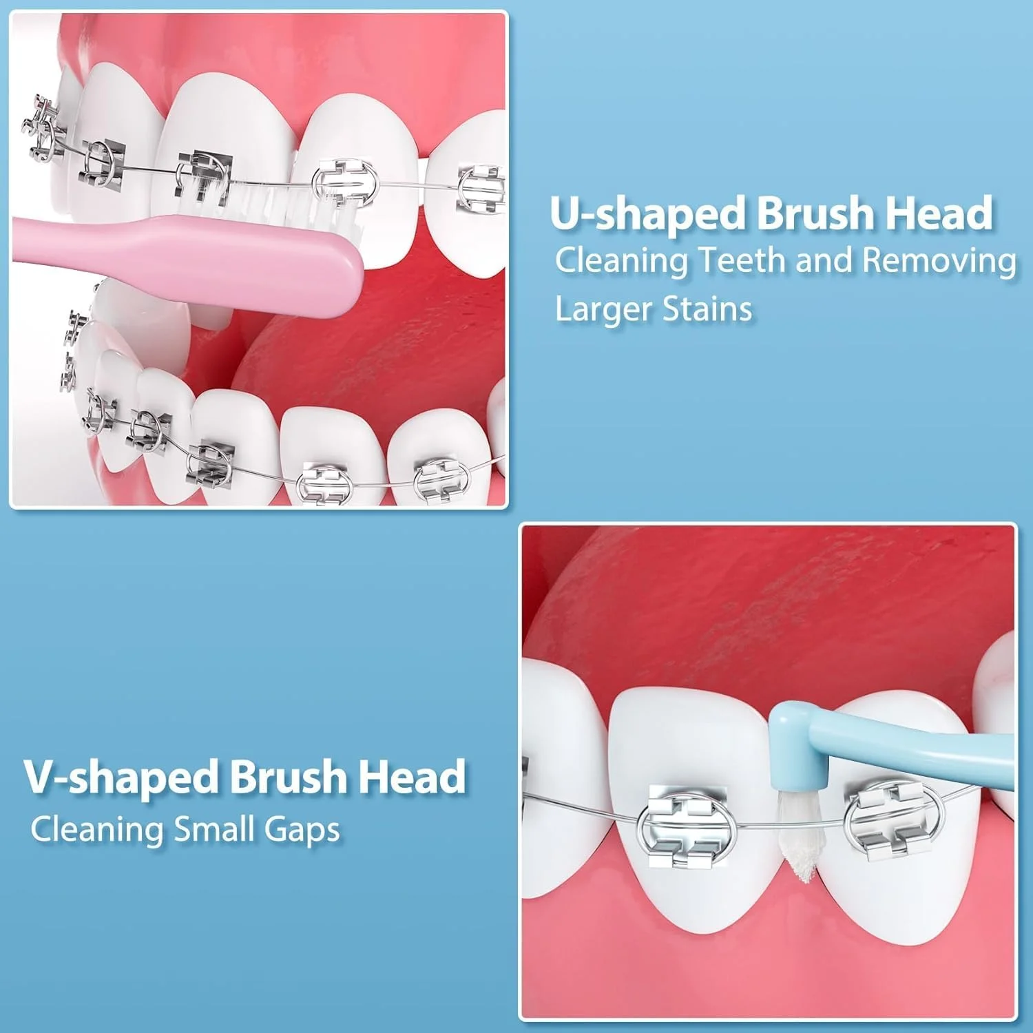 مسواک دسته دار 6 عددی، مسواک ارتودنسی دو سر، مسواک با برس های V شکل، مسواک تک دسته باریک، مسواک دستی برای نوجوانان و بزرگسالان، برای تمیز کردن دقیق براکت ها