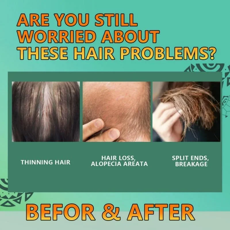 شامپو بار روغن باتانا NALACAL برای رشد مو، بار روغن باتانا ارگانیک از هندوراس، بدون سیلیکون، بار باتانا طبیعی برای جلوگیری از ریزش مو، ضخیم کننده، حجم دهنده، رشد مجدد برای موهای نازک (آبی) شامپو بار روغن باتانا NALACAL برای رشد مو، بار روغن باتانا ارگانیک از هندوراس، بدون سیلیکون، بار باتانا طبیعی برای جلوگیری از ریزش مو، ضخیم کننده، حجم دهنده، رشد مجدد برای موهای نازک (آبی)