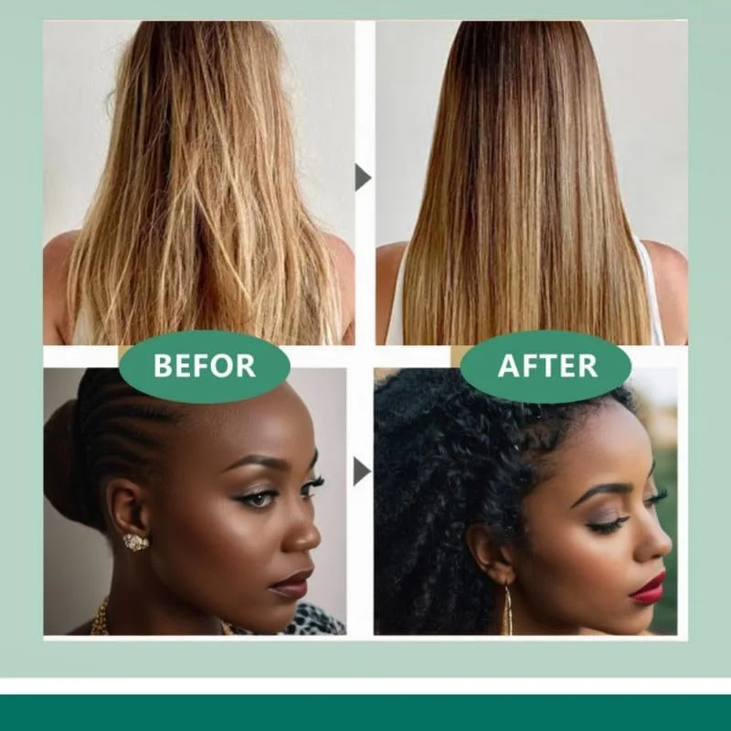 شامپو بار روغن باتانا NALACAL برای رشد مو، بار روغن باتانا ارگانیک از هندوراس، بدون سیلیکون، بار باتانا طبیعی برای جلوگیری از ریزش مو، ضخیم کننده، حجم دهنده، رشد مجدد برای موهای نازک (آبی) شامپو بار روغن باتانا NALACAL برای رشد مو، بار روغن باتانا ارگانیک از هندوراس، بدون سیلیکون، بار باتانا طبیعی برای جلوگیری از ریزش مو، ضخیم کننده، حجم دهنده، رشد مجدد برای موهای نازک (آبی)