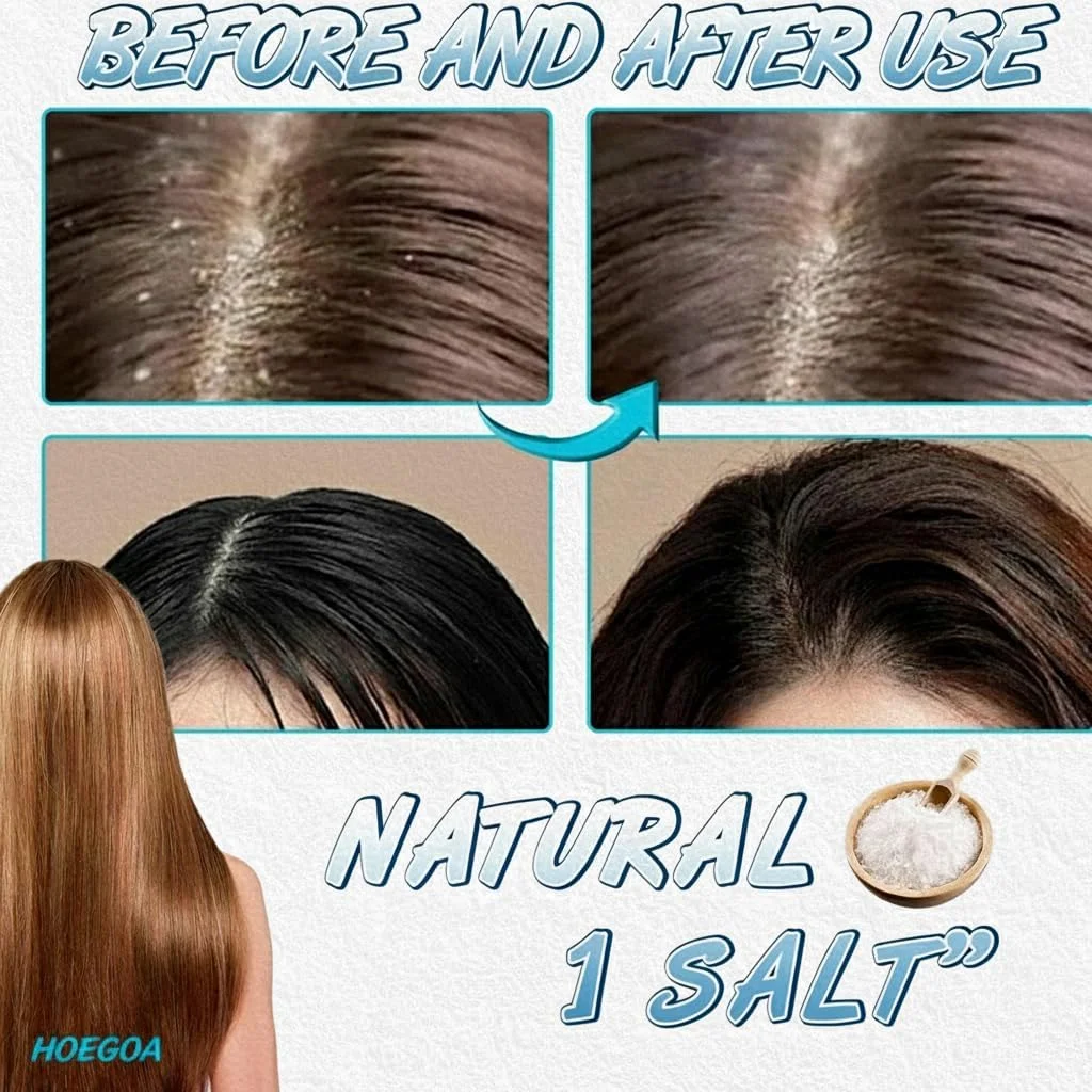 شامپو نمک دریایی NALACAL - شامپو ضد شوره و سم زدای پوست سر، فرمول آبرسان برای تسکین خارش پوست سر، مراقبت عمیق پاک کننده و مغذی مو، 100 گرم شامپو نمک دریایی NALACAL - شامپو ضد شوره و سم زدای پوست سر، فرمول آبرسان برای تسکین خارش پوست سر، مراقبت عمیق پاک کننده و مغذی مو، 100 گرم