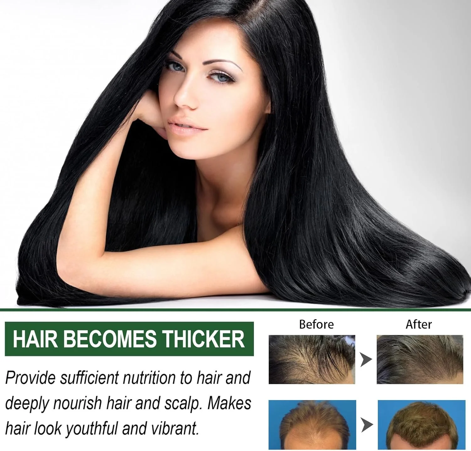 شامپو زنجبیلی رشد مو Azonee، شامپو فعال کننده ریشه، شامپو ضخیم کننده ضد ریزش مو با زنجبیل و کنجد، شامپو گیاهی برای تسکین خارش پوست سر خشک، تقویت رشد و صافی مو