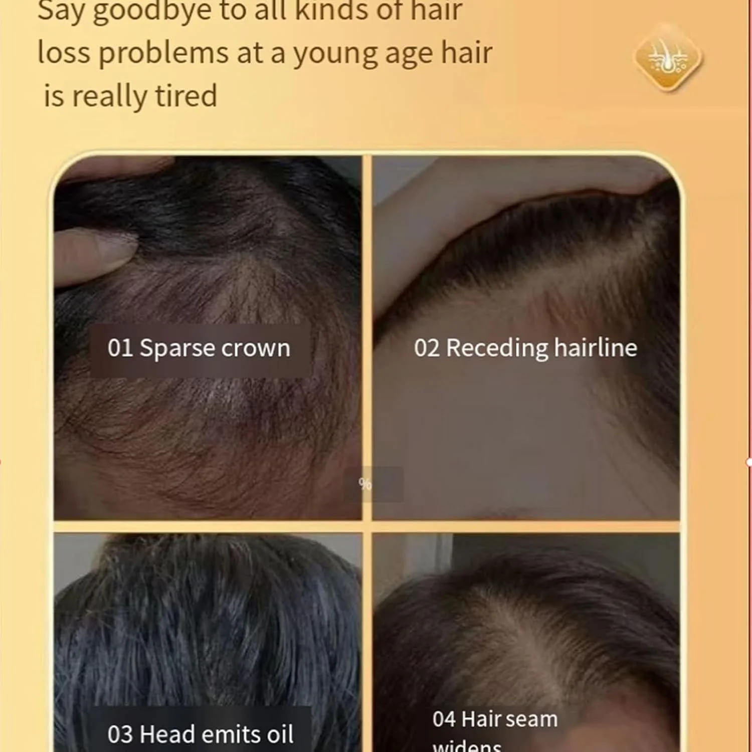 شامپو ضد ریزش مو و کنترل چربی Beautykomi مدل Odipie Beautykomi، قطره ضد ریزش موی گیاهی Beautykomi، نرم کننده مو ضد ریزش مو (2 عدد)