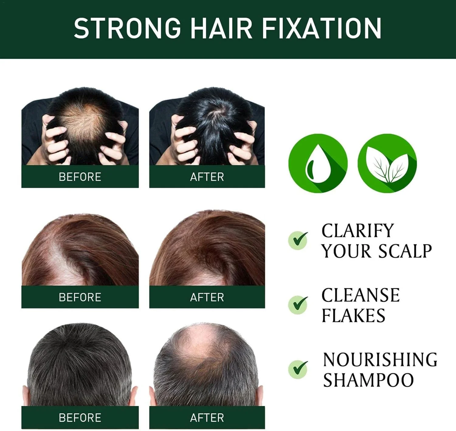 شامپو مراقبت از پوست سر زنجبیلی، شامپو گیاهی ضد خارش، شامپو مرطوب کننده مراقبت از پوست سر، شامپو با مواد طبیعی برای موهای نازک و ریزش مو شامپو مراقبت از پوست سر زنجبیلی، شامپو گیاهی ضد خارش، شامپو مرطوب کننده مراقبت از پوست سر، شامپو با مواد طبیعی برای موهای نازک و ریزش مو