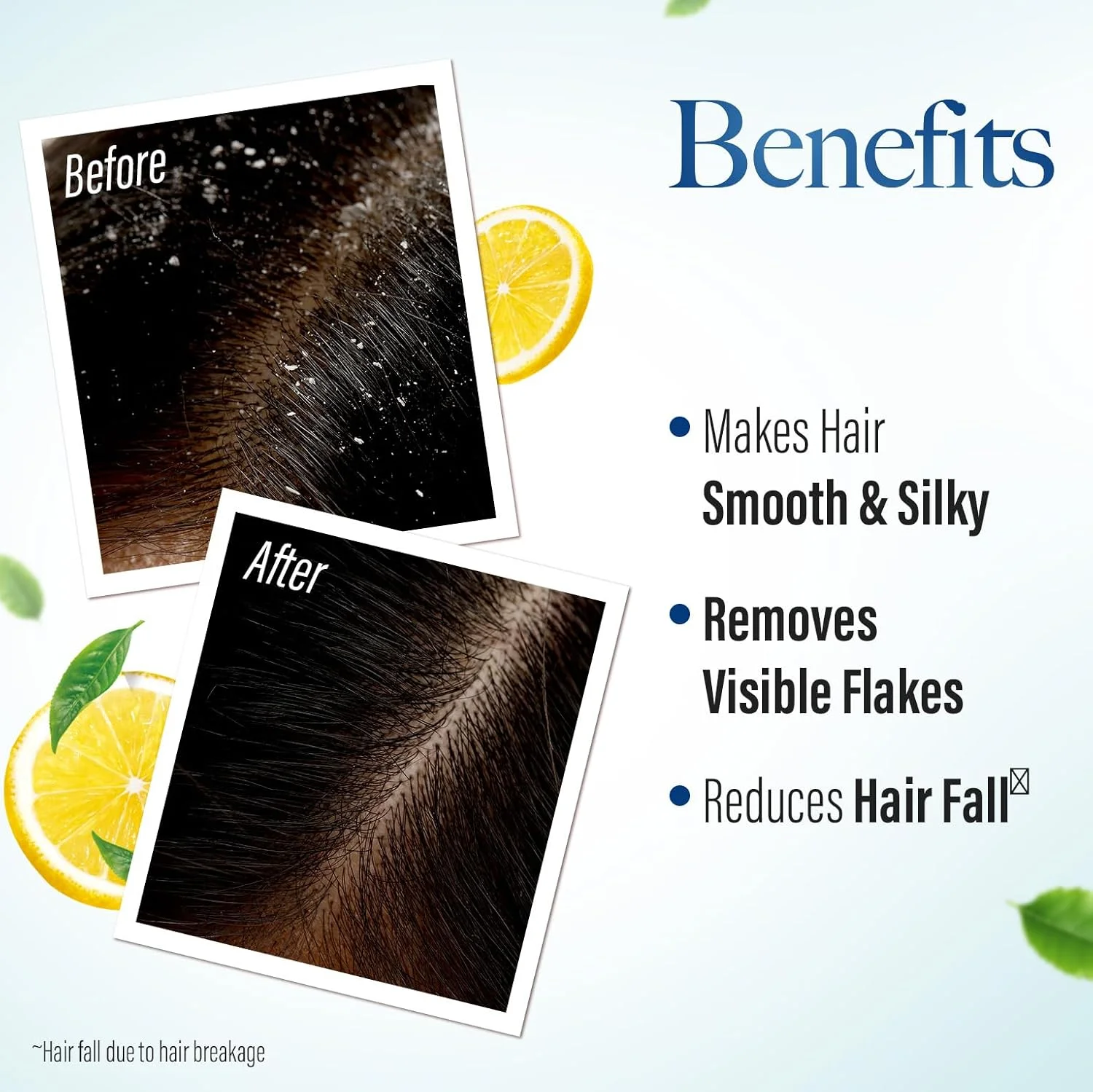 شامپو ضد شوره آیورودا کش کینگ، تا 100% بدون شوره، کاهش ریزش مو، 21 ماده طبیعی با خواص ماست، لیمو و چریش، مناسب برای آقایان و بانوان، 340 میلی لیتر شامپو ضد شوره آیورودا کش کینگ، تا 100% بدون شوره، کاهش ریزش مو، 21 ماده طبیعی با خواص ماست، لیمو و چریش، مناسب برای آقایان و بانوان، 340 میلی لیتر