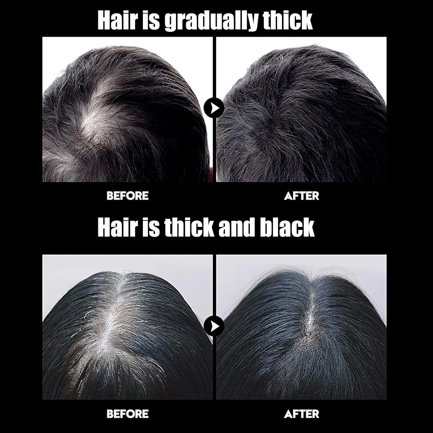 شامپو کنترل چربی 300 میلی لیتری، شامپو زنجبیل، کنترل چربی با عصاره زنجبیل، رفع شوره سر، ضد ریزش مو، شامپو تمیز کننده مو، مراقبت از مو برای آقایان و بانوان شامپو کنترل چربی 300 میلی لیتری، شامپو زنجبیل، کنترل چربی با عصاره زنجبیل، رفع شوره سر، ضد ریزش مو، شامپو تمیز کننده مو، مراقبت از مو برای آقایان و بانوان