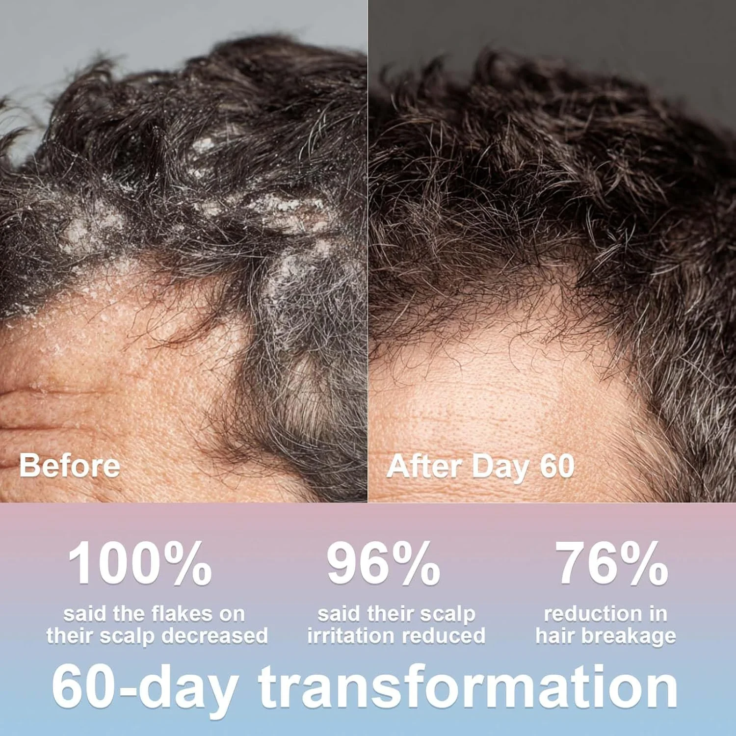 شامپو ضد شوره طبیعی فادویییو آسپيرا، 200 میلی لیتر – بدون سولفات، بدون رایحه های مصنوعی، تسکین دهنده پوست سر و تقویت کننده مو، فرمول مراقبت از ریشه