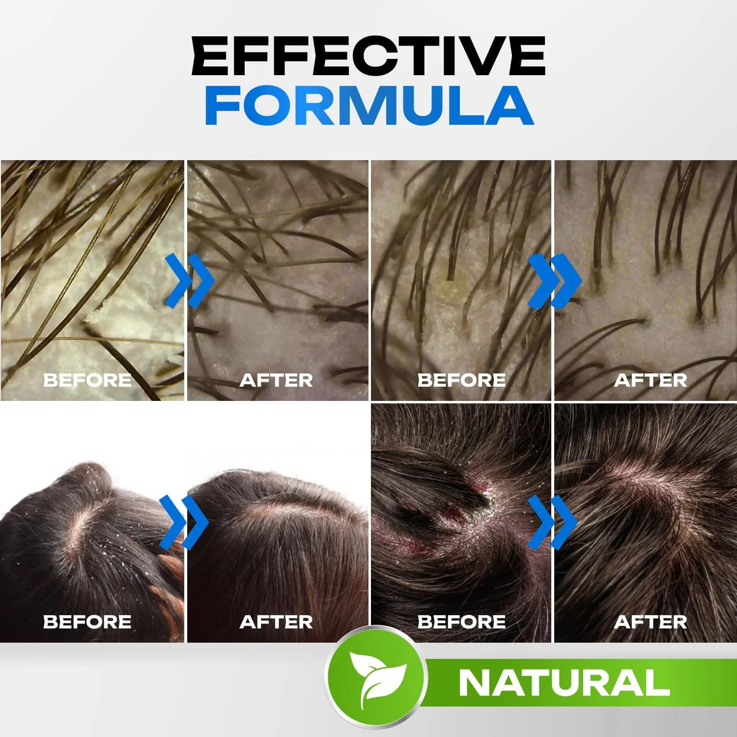 شامپو لایه بردار. پاک کننده پوست سر، از بین برنده شوره سر و موهای چرب، حجم دهنده، دارای اثر مقوی و پاک کننده. موهایی سالم و تمیز داشته باشید (300 میلی لیتر)