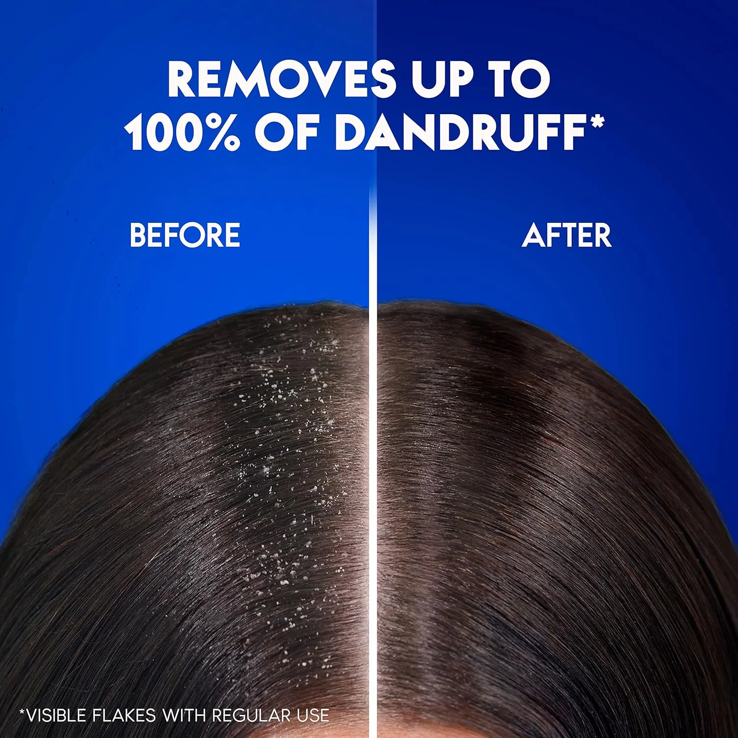 شامپو ضد شوره روزانه Head & Shoulders با فناوری MaxFoam، شوره سر دیگر برنمی گردد، از نظر بالینی ثابت شده، 400 میلی لیتر + 400 میلی لیتر شامپو ضد شوره روزانه Head & Shoulders با فناوری MaxFoam، شوره سر دیگر برنمی گردد، از نظر بالینی ثابت شده، 400 میلی لیتر + 400 میلی لیتر