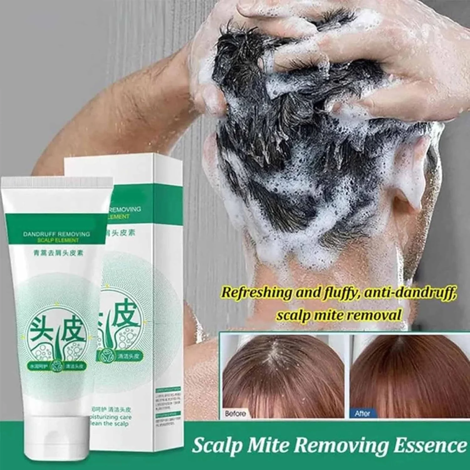 نرم کننده ضد شوره سر جیونار حاوی آرتمیزیا، شامپو ضد شوره سر پاک کننده، عنصر از بین برنده شوره سر، اسانس پوست سر ژاپنی، پاک کننده عمیق پوست سر، کنترل کننده چربی طراوت بخش پوست سر برای آقایان و بانوان (3 عدد)