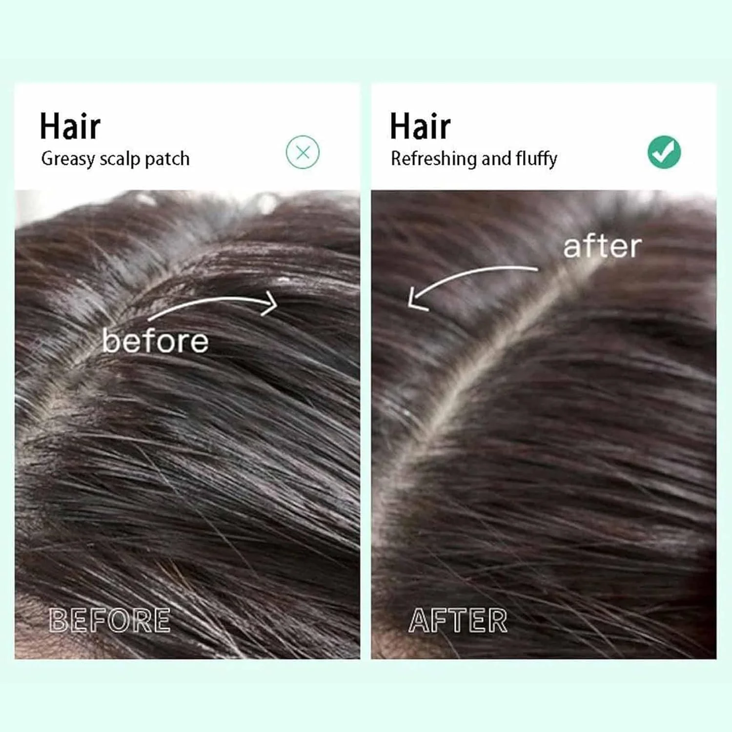 نرم کننده ضد شوره سر جیونار حاوی آرتمیزیا، شامپو ضد شوره سر پاک کننده، عنصر از بین برنده شوره سر، اسانس پوست سر ژاپنی، پاک کننده عمیق پوست سر، کنترل کننده چربی طراوت بخش پوست سر برای آقایان و بانوان (3 عدد)