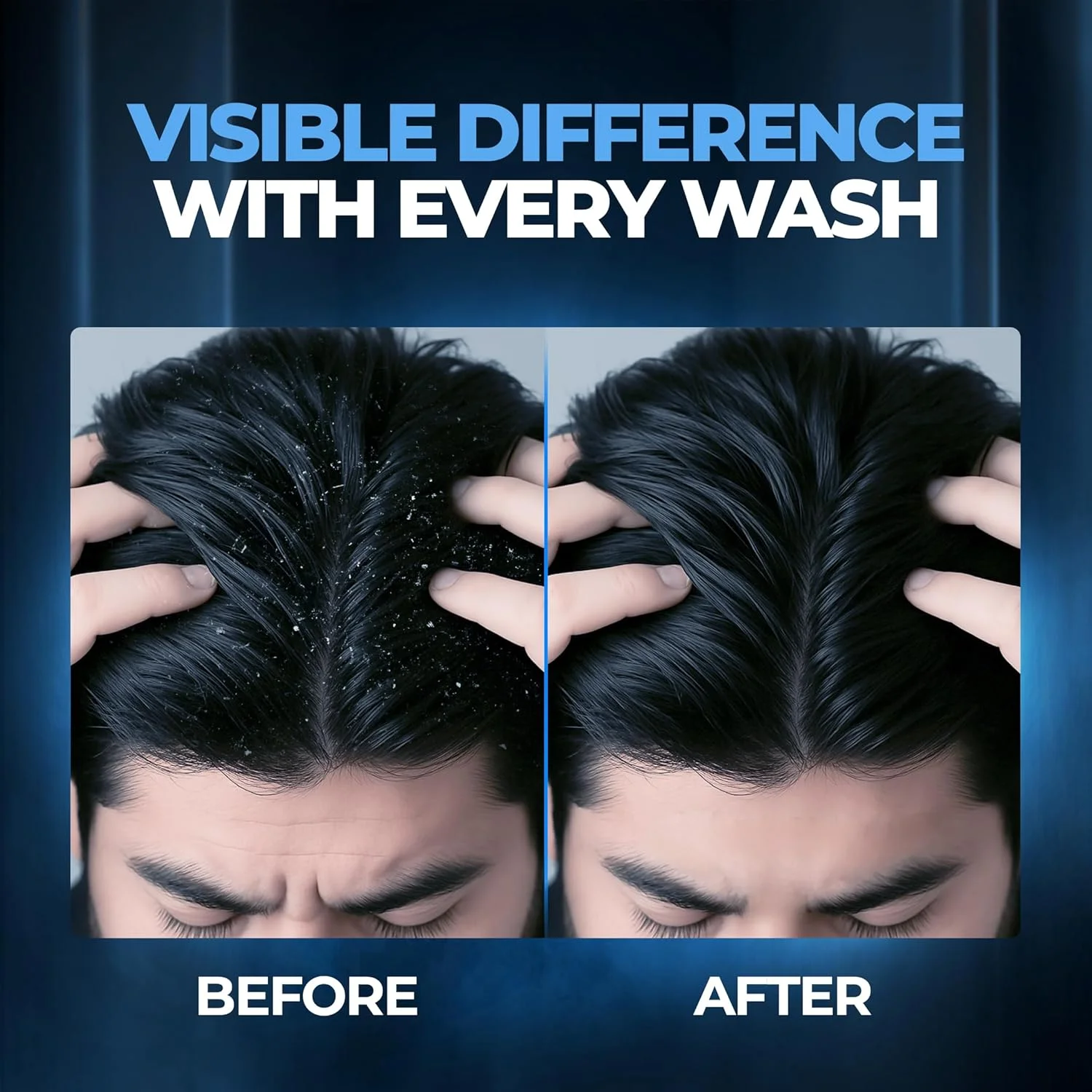 شامپو کنترل شوره سر بدون سولفات بی دی 200 میلی لیتر شامپو کنترل شوره سر بدون سولفات بی دی 200 میلی لیتر