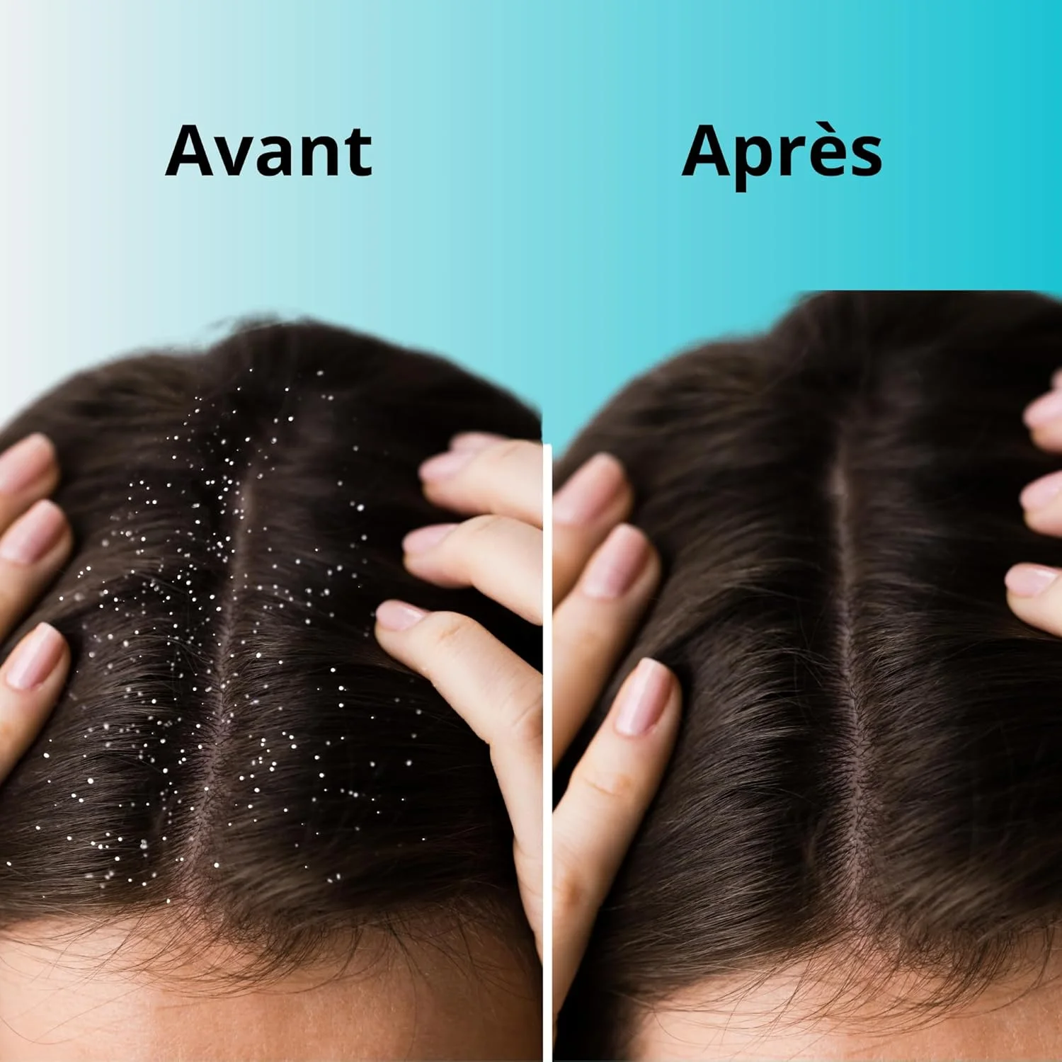 شامپو ضد شوره مو اینیا، 400 میلی لیتر، شامپو بدون سولفات، شامپو تسکین دهنده، برند فرانسوی