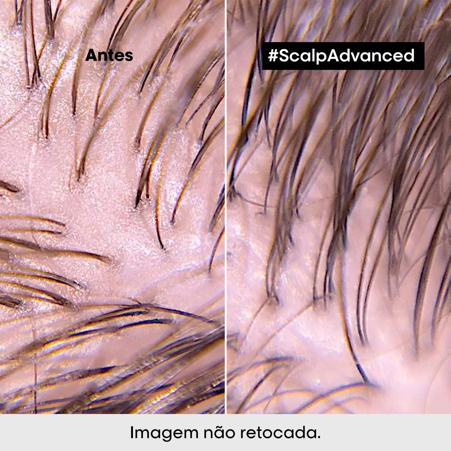 شامپو و ماسک 2 در 1 لورآل پروفشنال Scalp Advanced ضد چربی، پاک کننده عمقی خاک رس 500 میلی لیتر شامپو و ماسک 2 در 1 لورآل پروفشنال Scalp Advanced ضد چربی، پاک کننده عمقی خاک رس 500 میلی لیتر