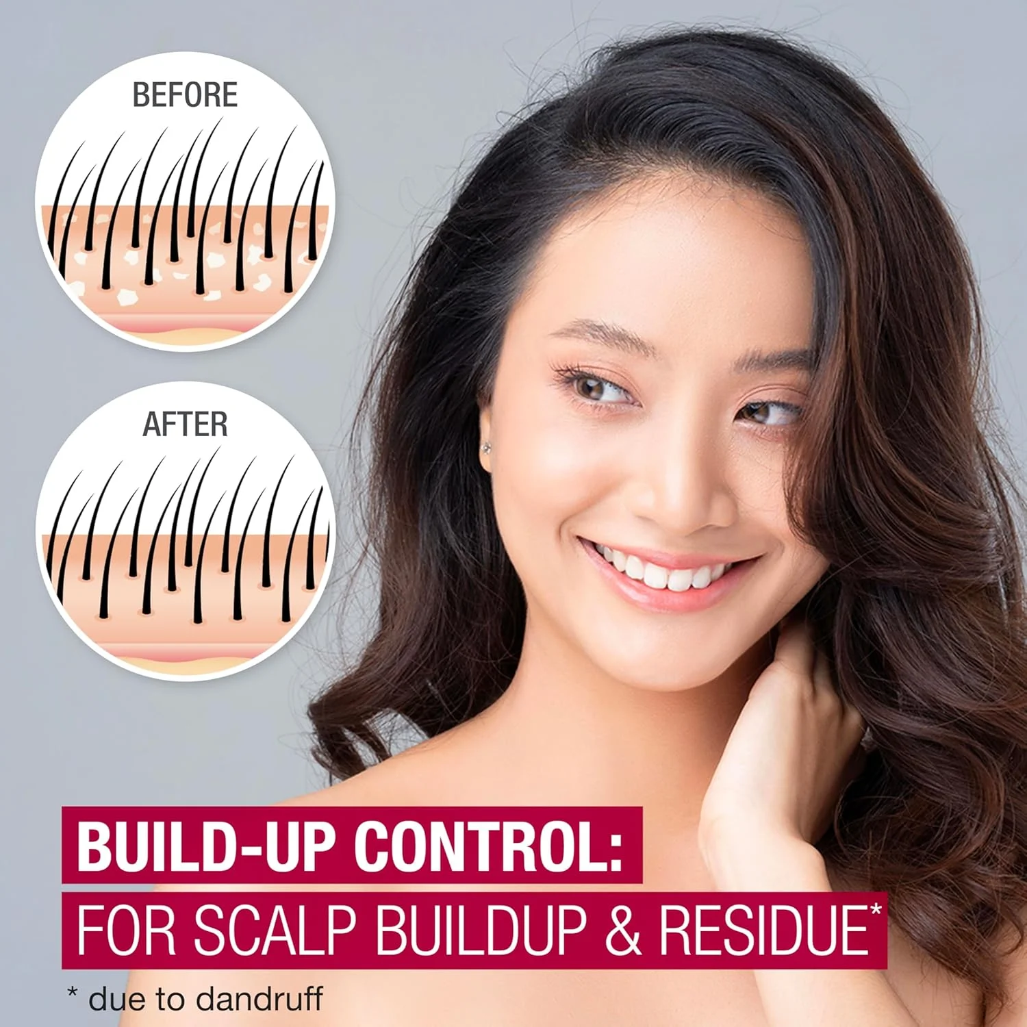 شامپو ضد شوره سر نوتروژینا، درمان پوست سر، کنترل تجمع پوست مرده، حاوی 2.5% اسید سالیسیلیک، با رایحه سرکه سیب، 355 میلی لیتر شامپو ضد شوره سر نوتروژینا، درمان پوست سر، کنترل تجمع پوست مرده، حاوی 2.5% اسید سالیسیلیک، با رایحه سرکه سیب، 355 میلی لیتر