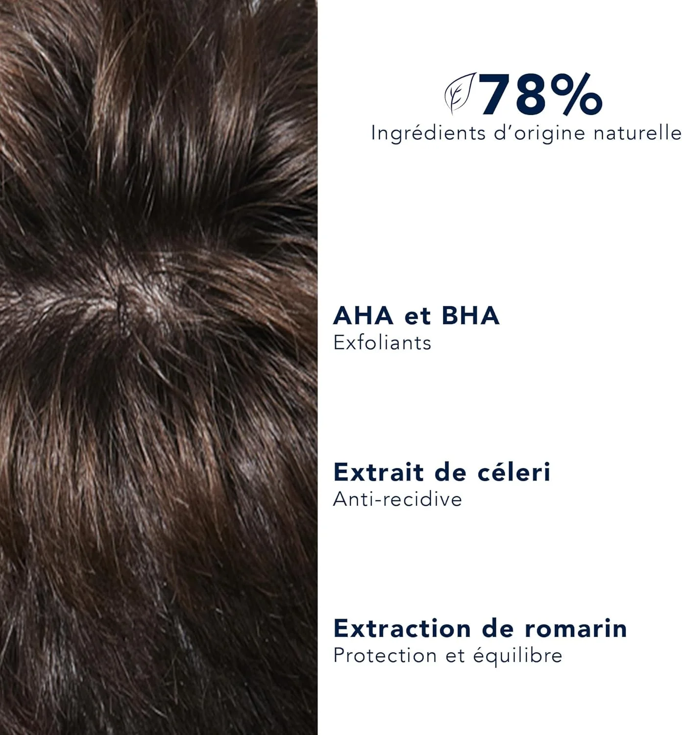 شامپو ضد شوره و درمان کننده فیتو درمو - فرمول AHA و BHA برای پوست سر بدون شوره، تسکین خارش - 250 میلی لیتر، فاقد سیلیکون