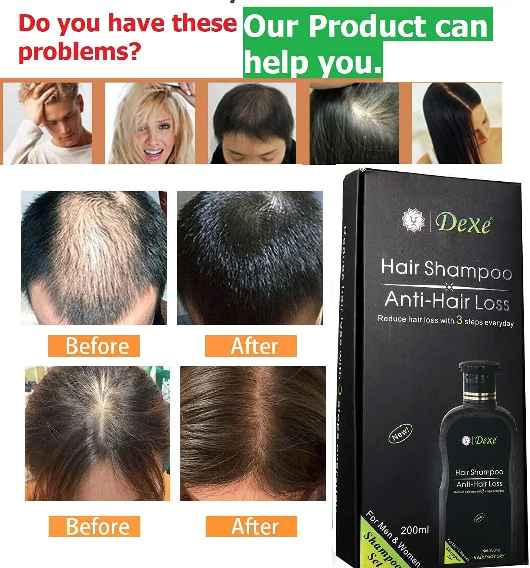 مجموعه شامپو دکس ضد ریزش موی مردانه و زنانه TSSPLUS، محصول رشد گیاهی چینی، جلوگیری از درمان مو (200 میلی لیتر) مجموعه شامپو دکس ضد ریزش موی مردانه و زنانه TSSPLUS، محصول رشد گیاهی چینی، جلوگیری از درمان مو (200 میلی لیتر)