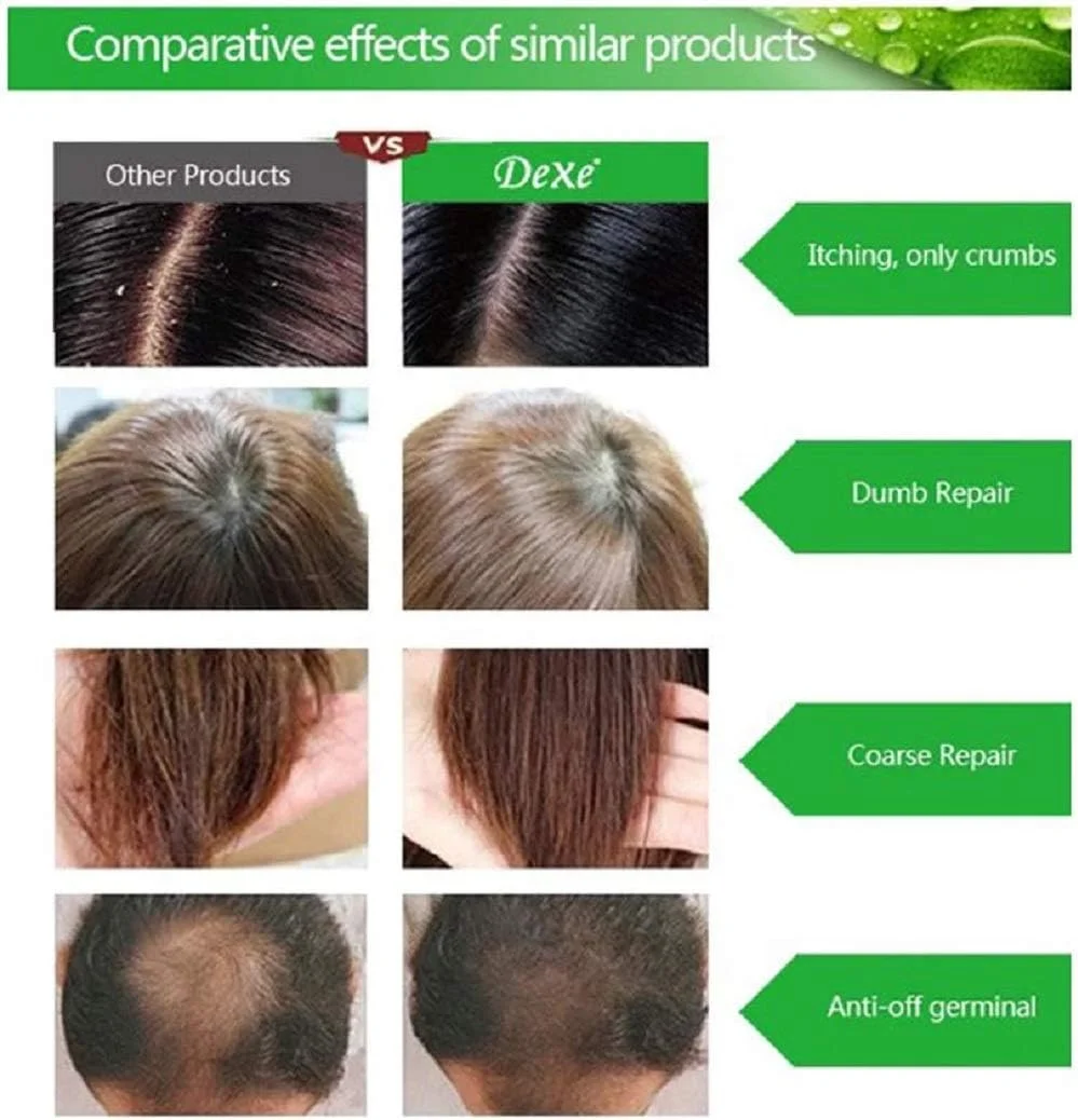 مجموعه شامپو دکس ضد ریزش موی مردانه و زنانه TSSPLUS، محصول رشد گیاهی چینی، جلوگیری از درمان مو (200 میلی لیتر) مجموعه شامپو دکس ضد ریزش موی مردانه و زنانه TSSPLUS، محصول رشد گیاهی چینی، جلوگیری از درمان مو (200 میلی لیتر)