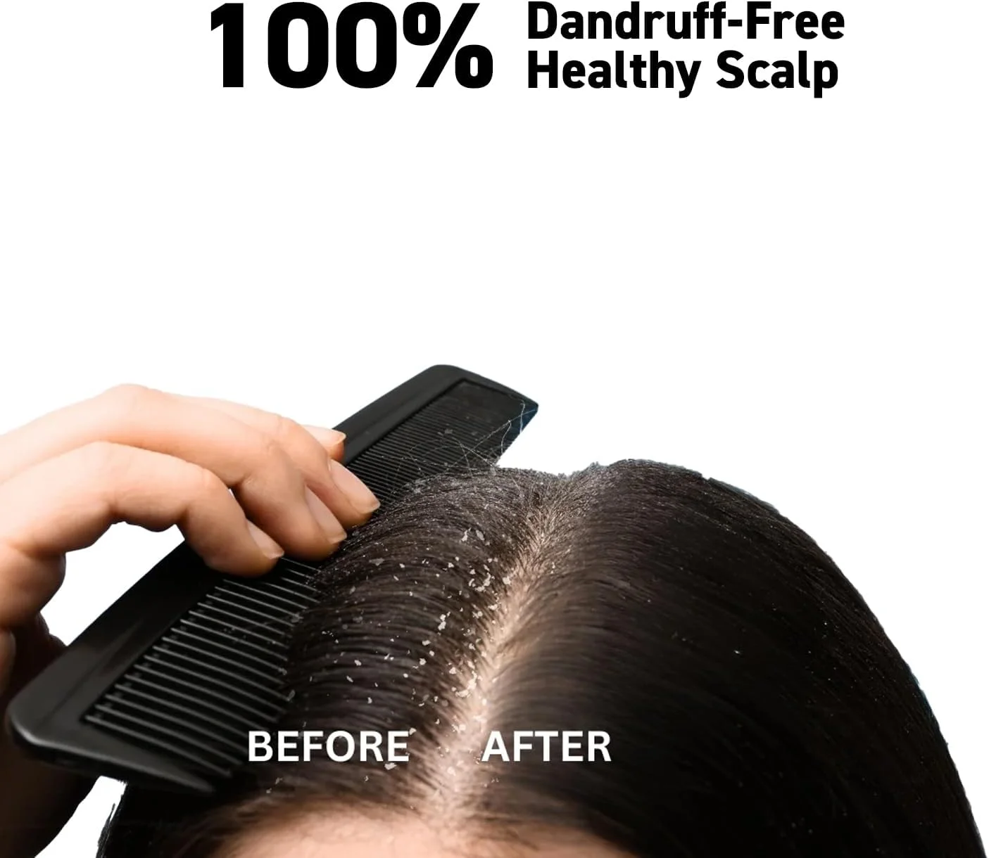 شامپو ضد شوره سر شرور برای زنان و مردان - کنترل موثر شوره سر، تسکین دهنده پوست سر، مراقبت مغذی مو - 200 میلی لیتر شامپو ضد شوره سر شرور برای زنان و مردان - کنترل موثر شوره سر، تسکین دهنده پوست سر، مراقبت مغذی مو - 200 میلی لیتر