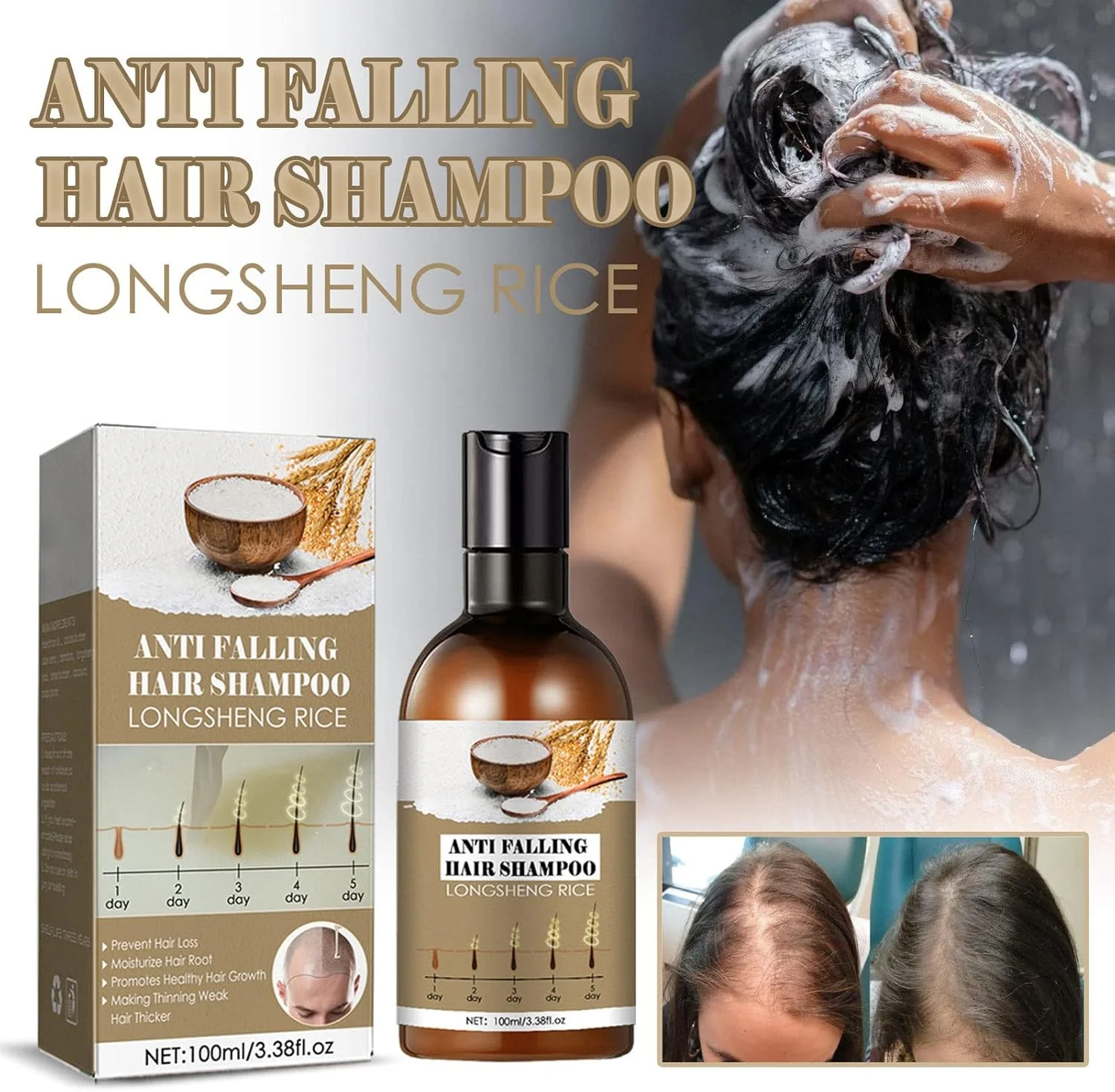 شامپو برنج برای مو، شامپو مراقبت از مو 2 عددی، شامپو رفع شوره سر، شامپو مراقبت از ریزش مو، شامپو ضخیم کننده مو، شامپو ضد ریزش مو و رشد مجدد شامپو برنج برای مو، شامپو مراقبت از مو 2 عددی، شامپو رفع شوره سر، شامپو مراقبت از ریزش مو، شامپو ضخیم کننده مو، شامپو ضد ریزش مو و رشد مجدد
