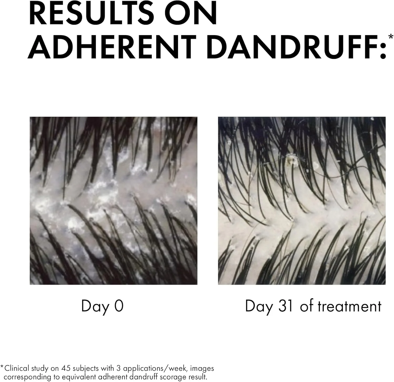 شامپو ضد شوره موهای خشک ویشی درکوس شامپو ضد شوره موهای خشک ویشی درکوس