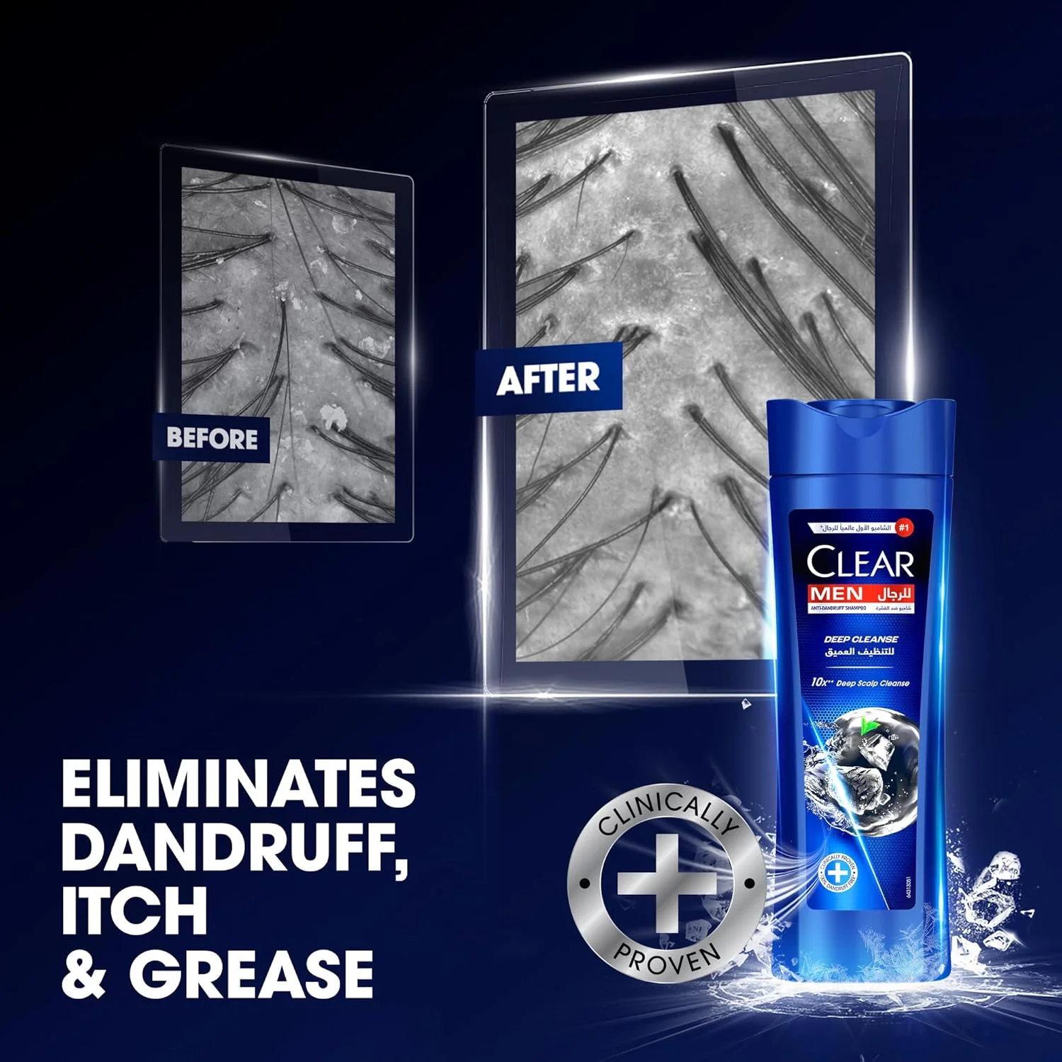 شامپو کلیر مردانه، شامپو ضد شوره، پاکسازی عمیق، پاکسازی عمیق پوست سر 10 برابر**، 350 میلی لیتر شامپو کلیر مردانه، شامپو ضد شوره، پاکسازی عمیق، پاکسازی عمیق پوست سر 10 برابر**، 350 میلی لیتر