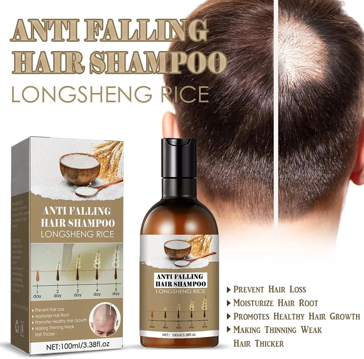 شامپو برنج برای مو، شامپو مراقبت از مو 2 عددی، شامپو رفع شوره سر، شامپو مراقبت از ریزش مو، شامپو ضخیم کننده مو، شامپو ضد ریزش مو و رشد مجدد شامپو برنج برای مو، شامپو مراقبت از مو 2 عددی، شامپو رفع شوره سر، شامپو مراقبت از ریزش مو، شامپو ضخیم کننده مو، شامپو ضد ریزش مو و رشد مجدد