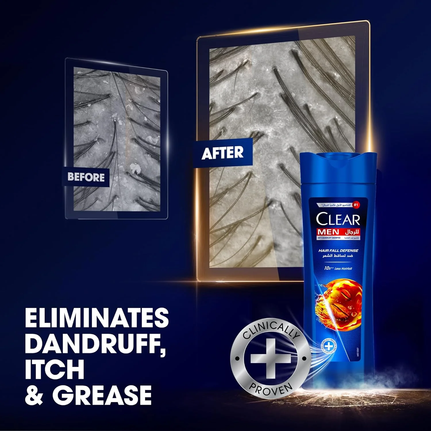 شامپو کلیر مردانه، شامپو ضد شوره، محافظت از ریزش مو، کاهش 10 برابری** ریزش مو، 600 میلی لیتر شامپو کلیر مردانه، شامپو ضد شوره، محافظت از ریزش مو، کاهش 10 برابری** ریزش مو، 600 میلی لیتر