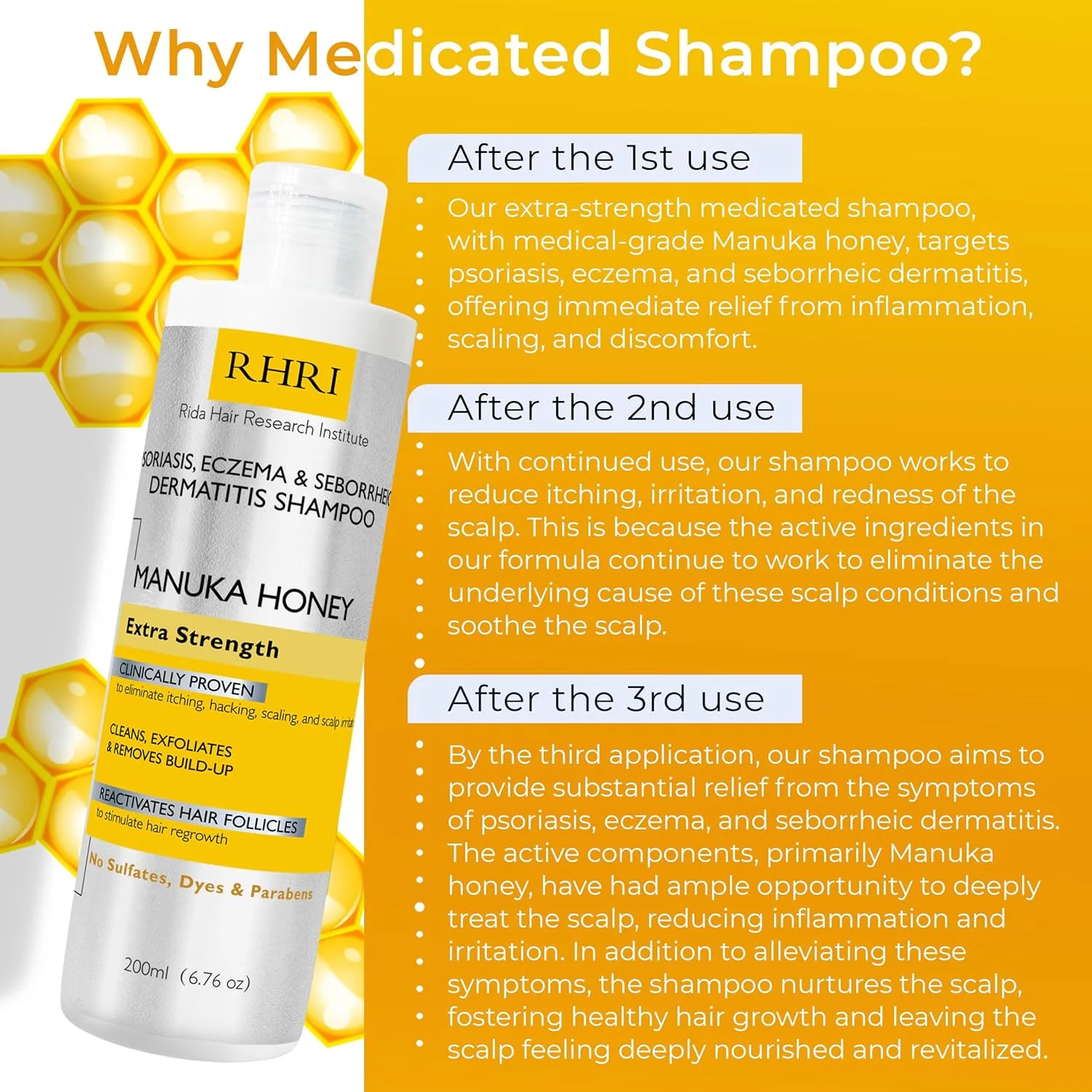 شامپو پسوریازیس موسسه تحقیقات موی ریدا حاوی عسل مانوکا، مناسب آقایان و بانوان | بهترین درمان خارش پوست سر برای اگزما، درماتیت سبورئیک، قارچ و فولیکولیت شامپو پسوریازیس موسسه تحقیقات موی ریدا حاوی عسل مانوکا، مناسب آقایان و بانوان | بهترین درمان خارش پوست سر برای اگزما، درماتیت سبورئیک، قارچ و فولیکولیت