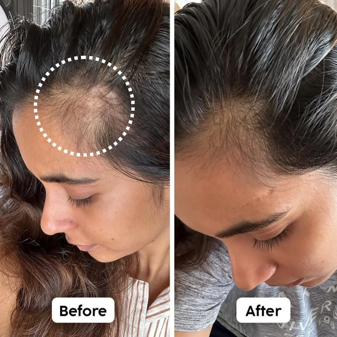 شامپو بار رزماری و برنج رپلن هیر برای آقایان و بانوان، شامپو ضد شوره سر با محلول مراقبت از مو بدون مواد شیمیایی برای رشد مو، شامپو بدون سولفات برای رشد مجدد، ضد ریزش مو و کنترل شوره سر شامپو بار رزماری و برنج رپلن هیر برای آقایان و بانوان، شامپو ضد شوره سر با محلول مراقبت از مو بدون مواد شیمیایی برای رشد مو، شامپو بدون سولفات برای رشد مجدد، ضد ریزش مو و کنترل شوره سر