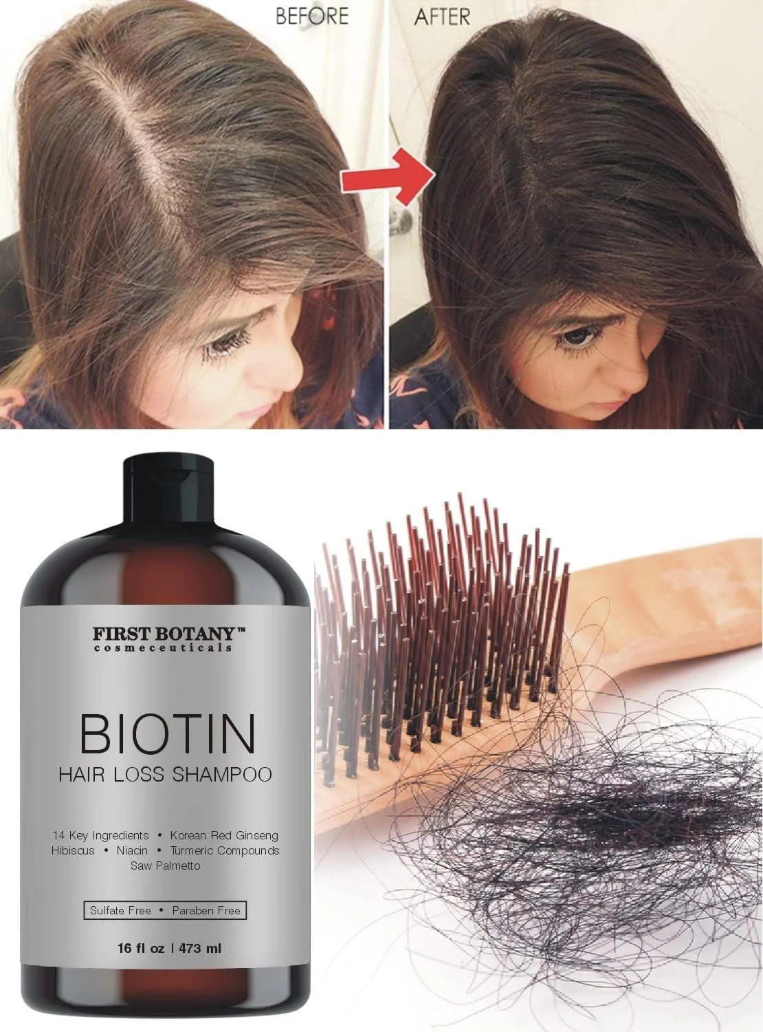 شامپو ضد ریزش مو و رشد مجدد مو فرست بوتانی Cosmeceuticals، 473 میلی لیتر، با مسدود کننده های DHT - شامپو آبرسان، سم زدا و حجم دهنده روزانه برای آقایان و بانوان شامپو ضد ریزش مو و رشد مجدد مو فرست بوتانی Cosmeceuticals، 473 میلی لیتر، با مسدود کننده های DHT - شامپو آبرسان، سم زدا و حجم دهنده روزانه برای آقایان و بانوان