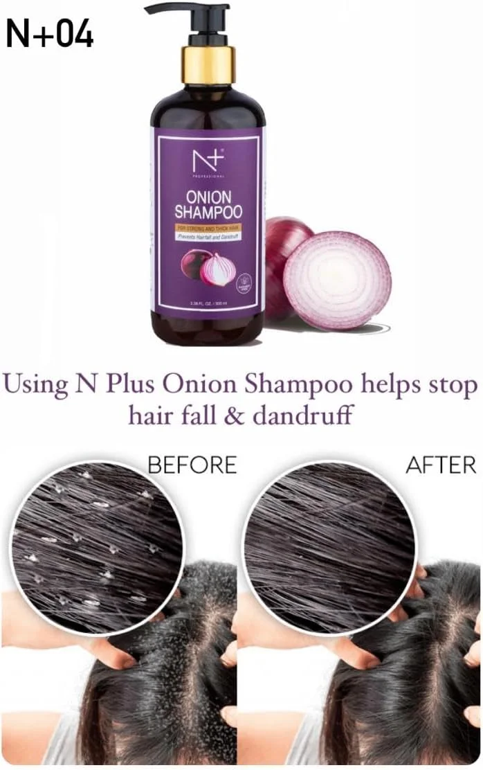 شامپو پیاز حرفه ای NPOLE N+، جلوگیری از ریزش مو و شوره سر، موهایی نرم تر و قوی تر را به ارمغان می آورد شامپو پیاز حرفه ای NPOLE N+، جلوگیری از ریزش مو و شوره سر، موهایی نرم تر و قوی تر را به ارمغان می آورد