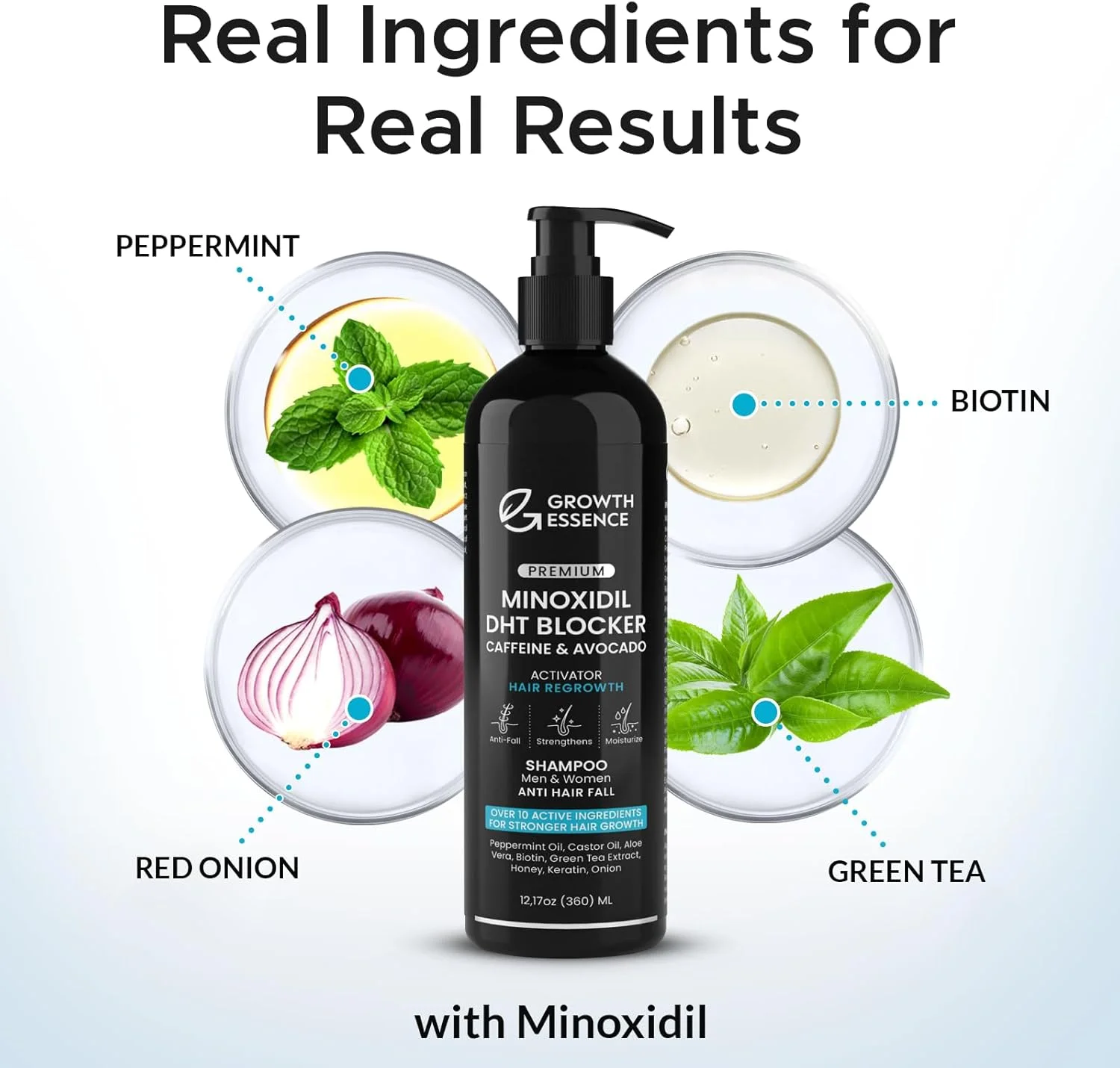 شامپو ماینوکسیدیل و بیوتین برای رشد مو - غنی شده با کافئین، روغن کرچک و پیاز - مسدود کننده DHT برای موهای ضخیم تر و سالم تر - فرمول تقویت کننده برای آقایان و بانوان